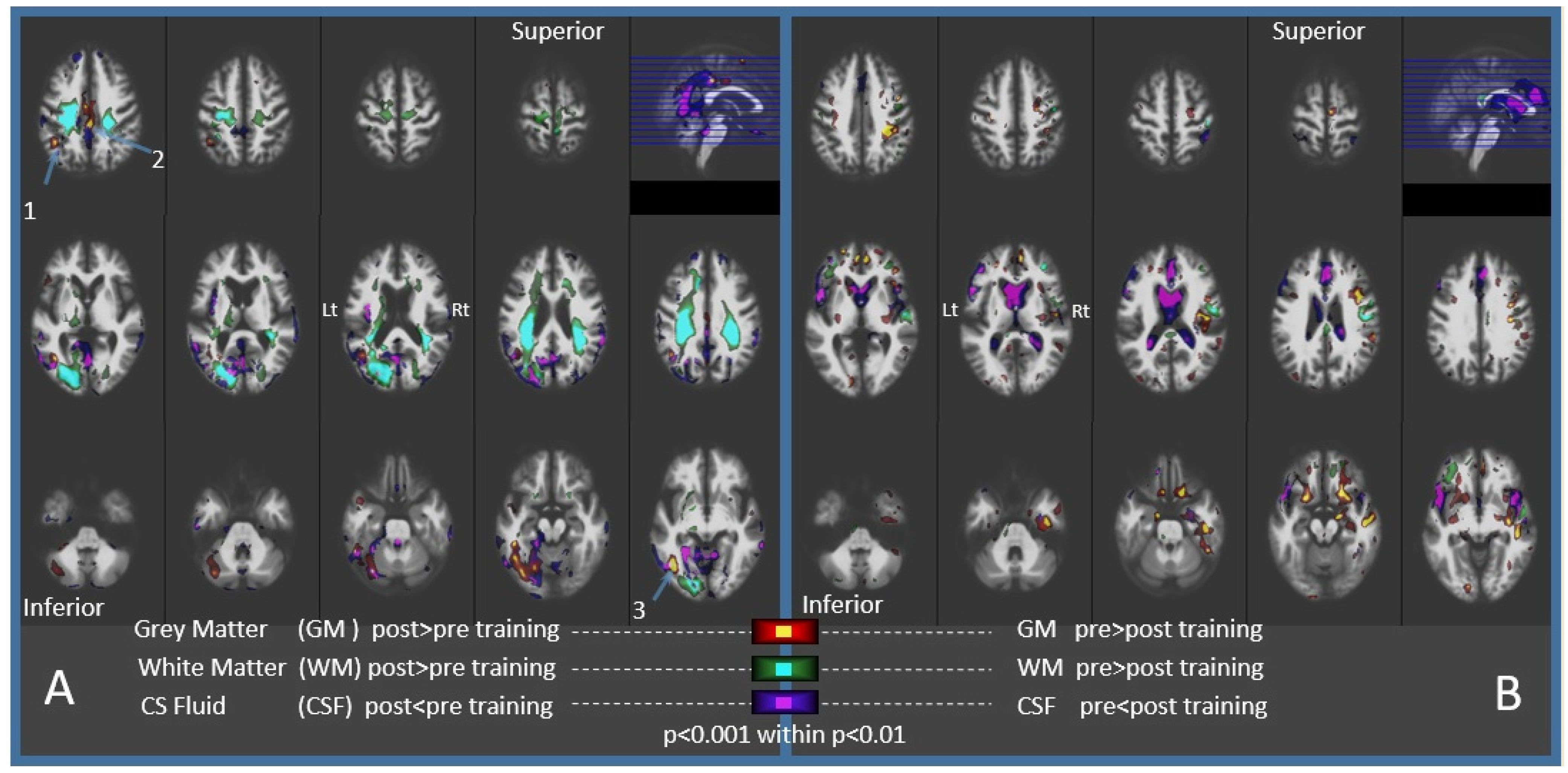 Brainsci 11 01637 g002