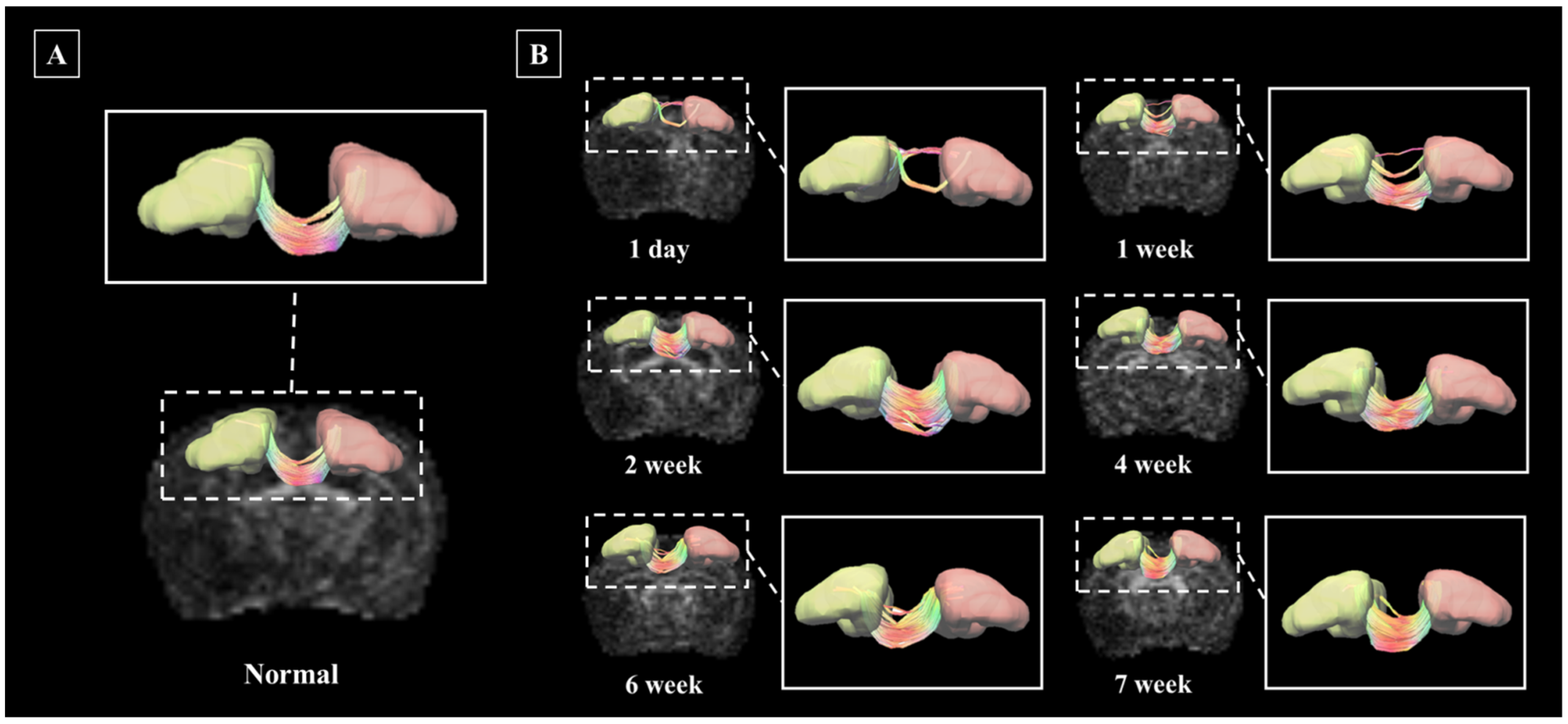 Brainsci 11 01656 g006