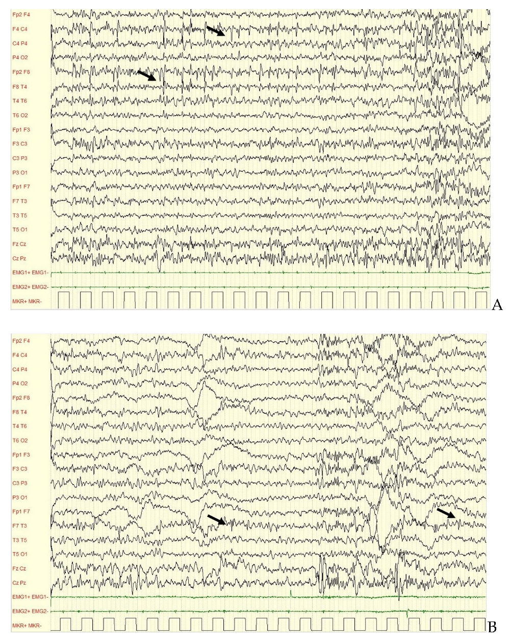 Brainsci 12 00018 g002 550
