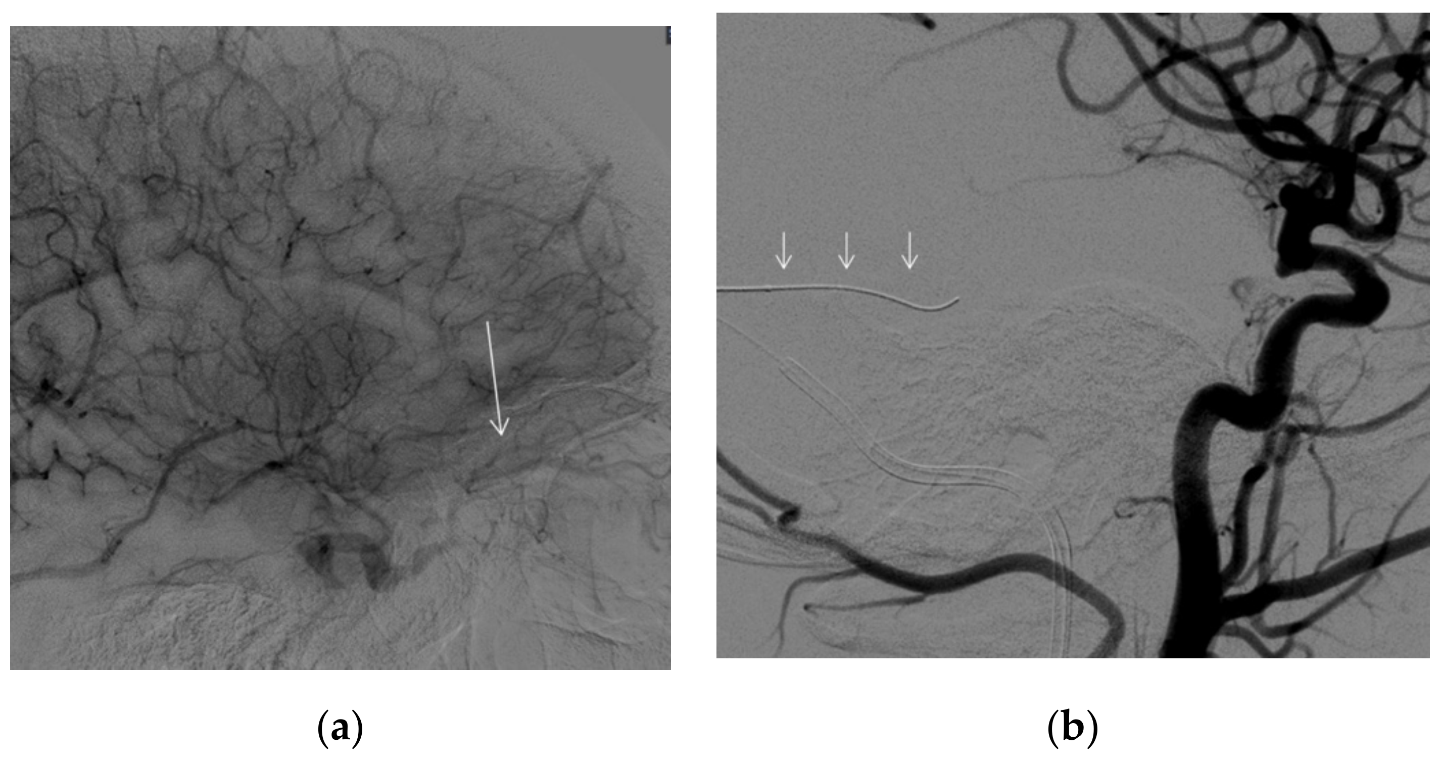 Brainsci 12 00045 g004