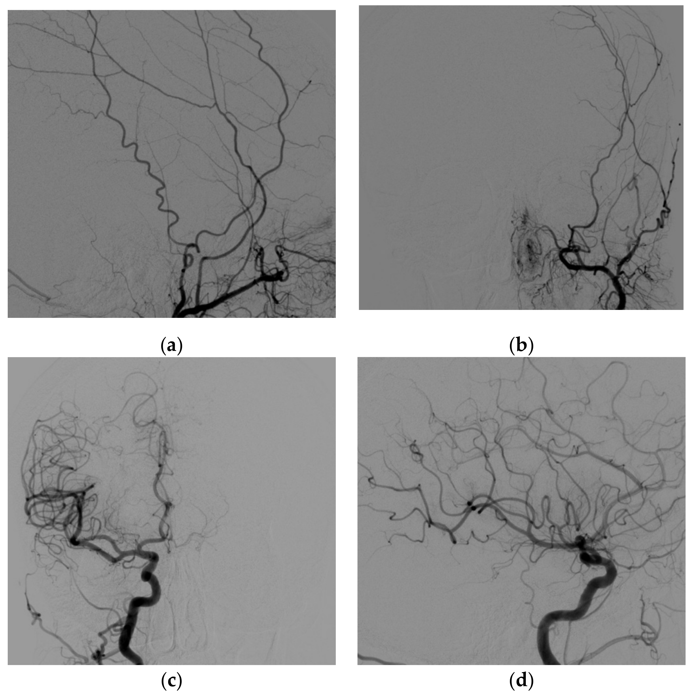 Brainsci 12 00045 g006