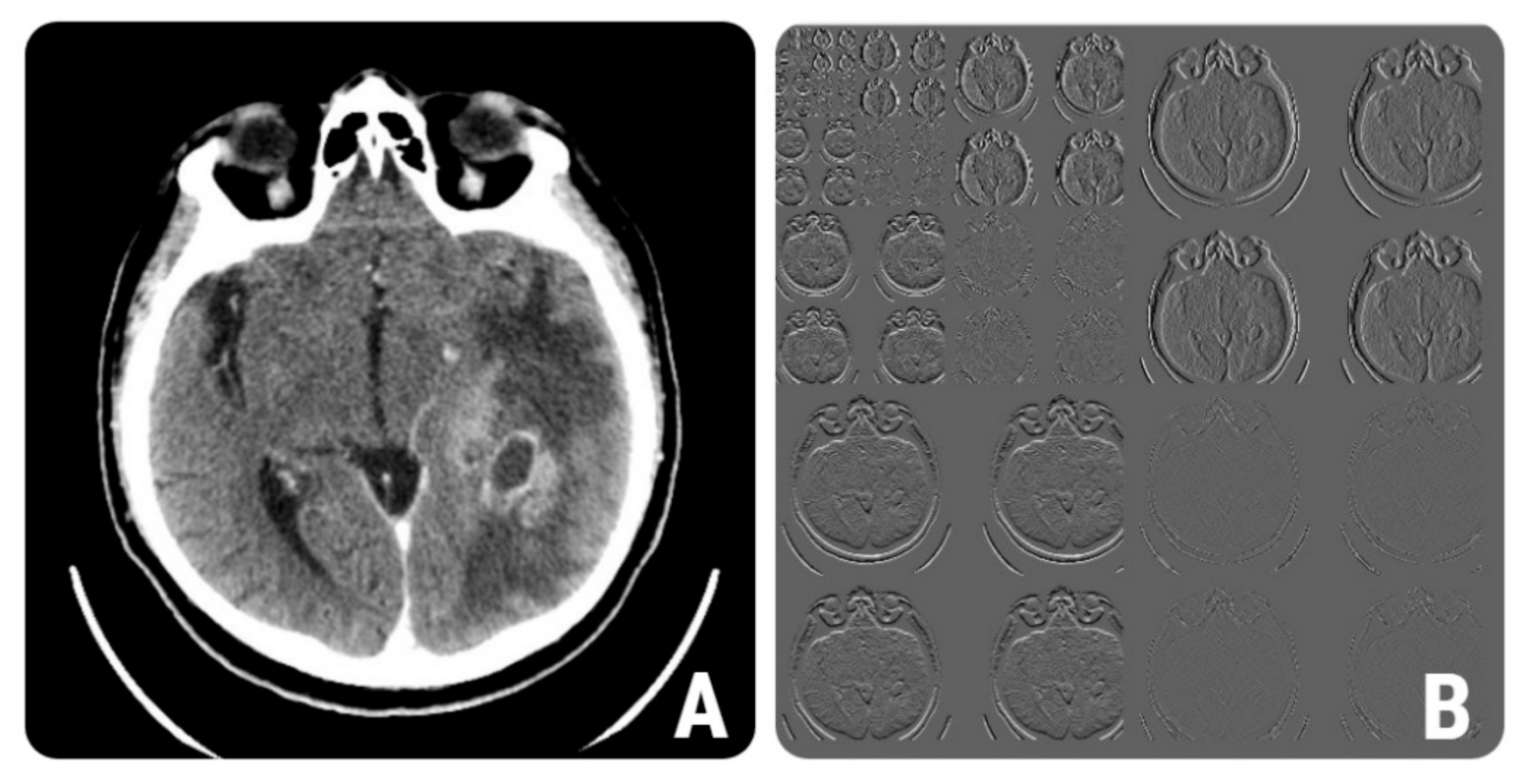Brainsci 12 00109 g005