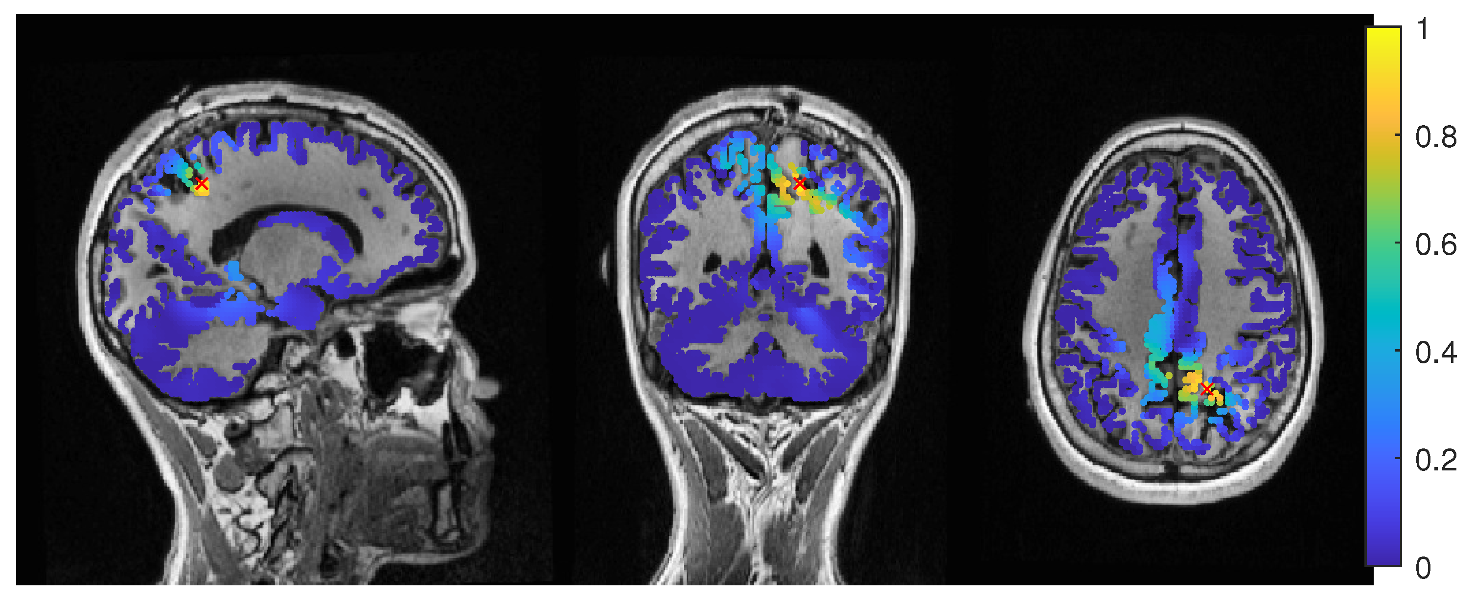 Brainsci 12 00114 g005 Brainsci 12 00114 g005