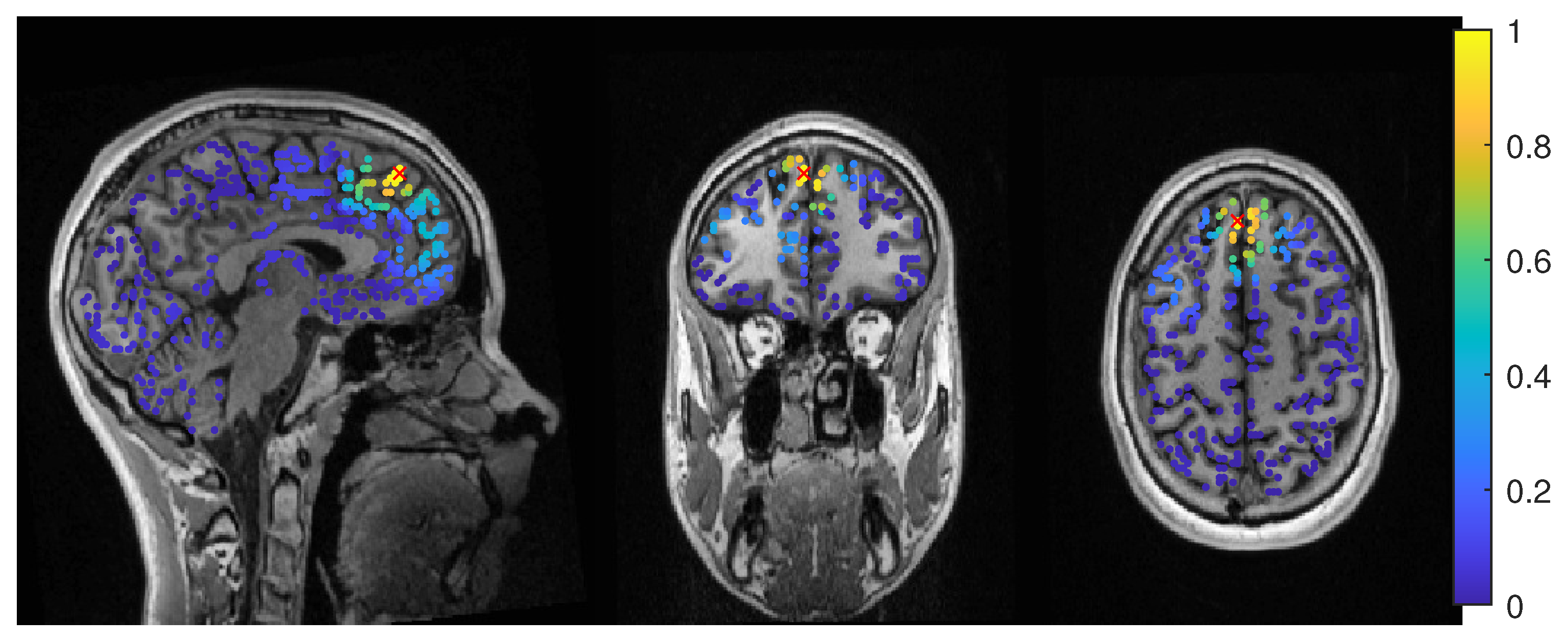 Brainsci 12 00114 g011 Brainsci 12 00114 g011