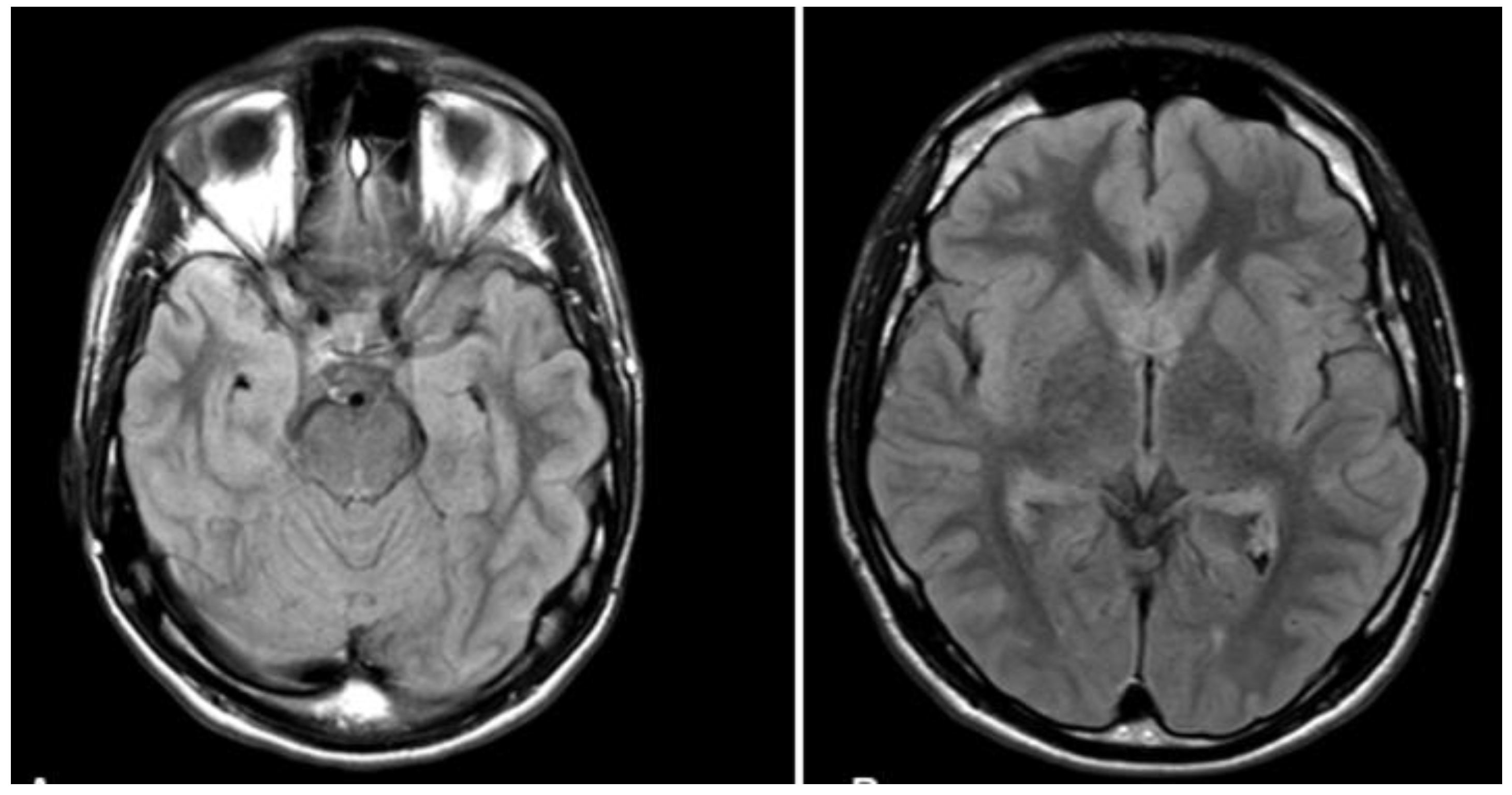 Brainsci 12 00115 g001 550