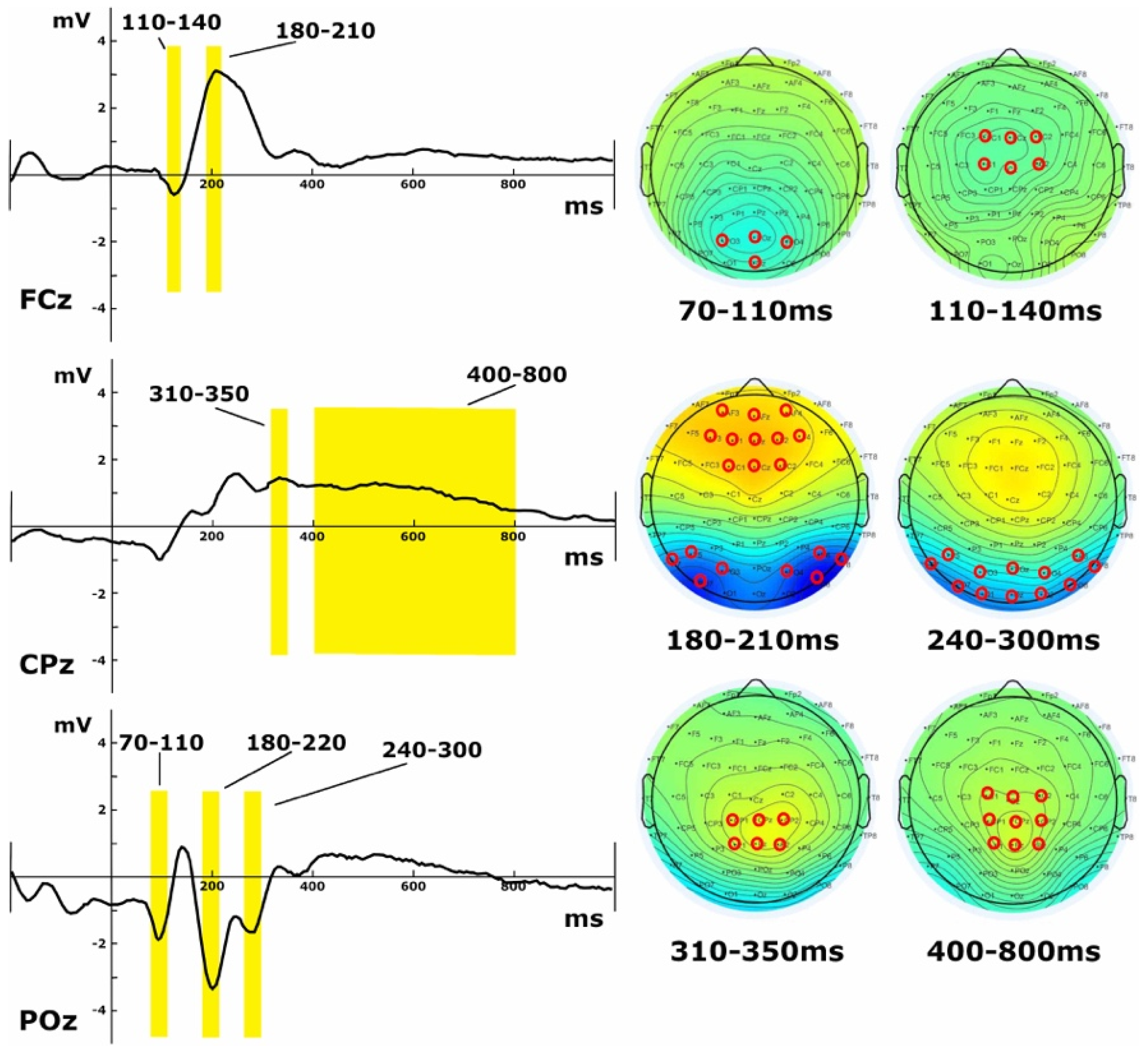 Brainsci 12 00145 g002 Brainsci 12 00145 g002