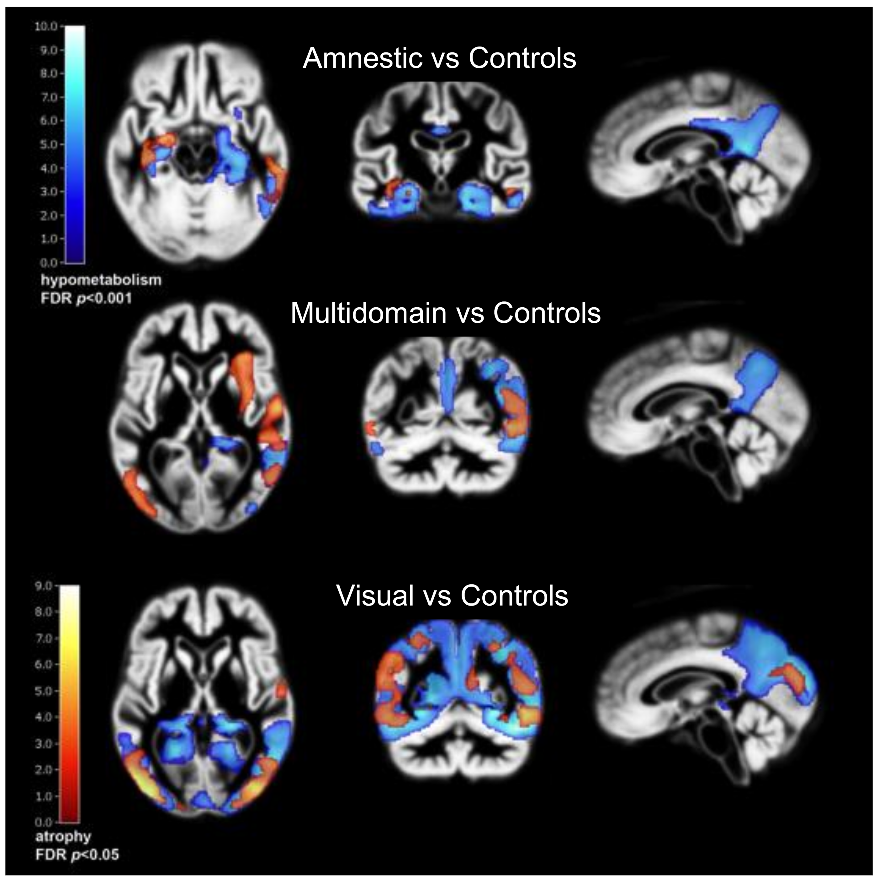 Brainsci 12 00146 g002