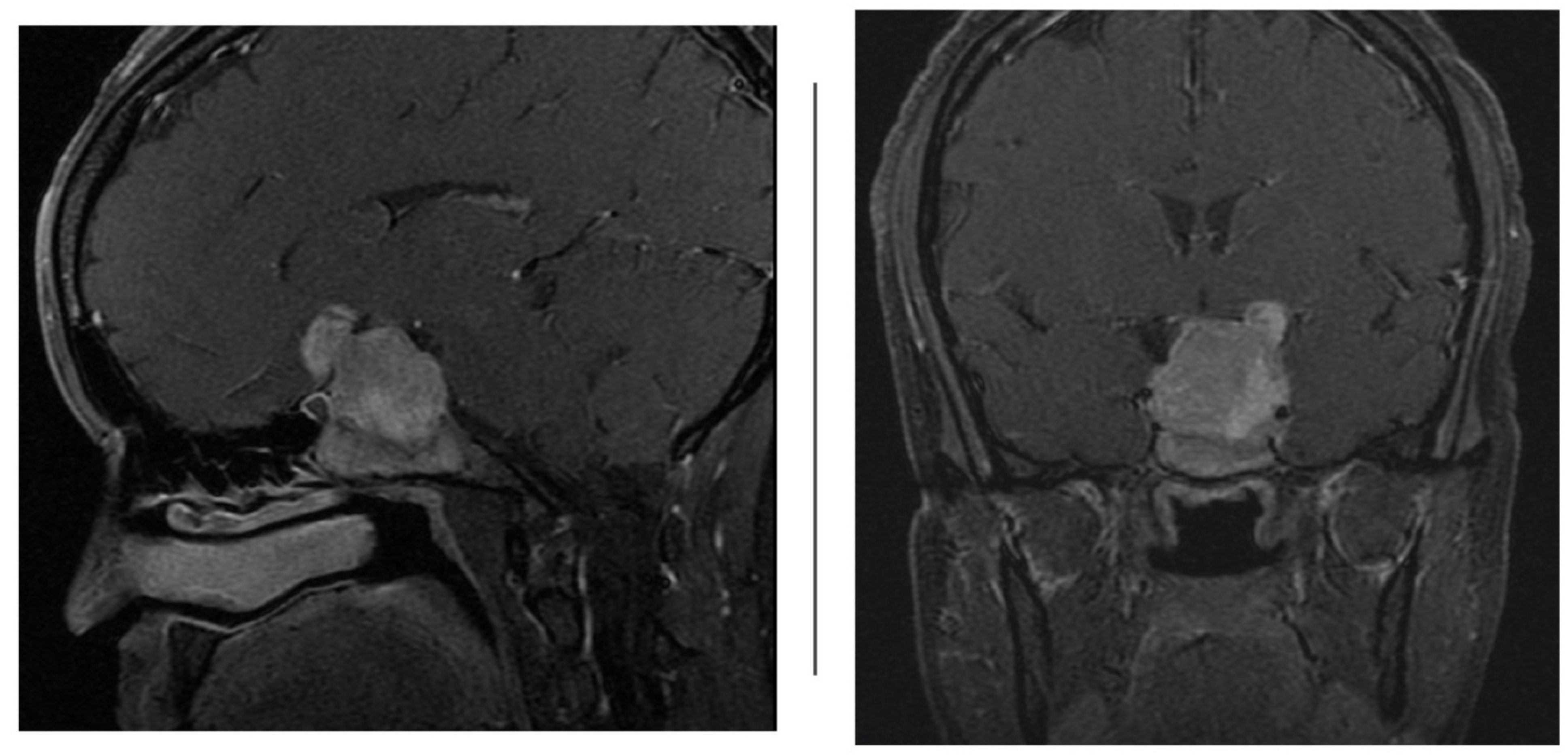 Brainsci 12 00152 g002 550