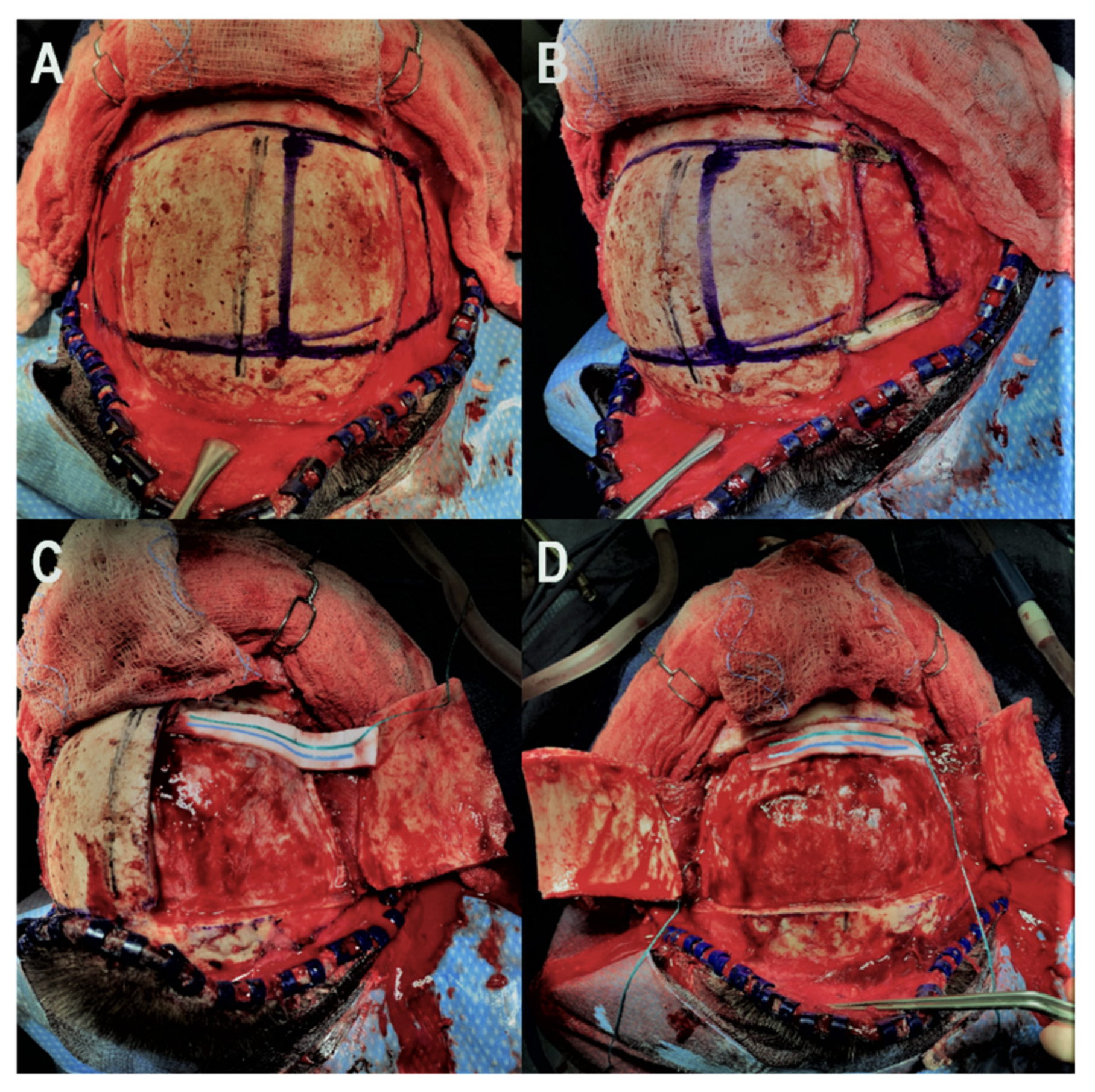 Brainsci 12 00163 g001