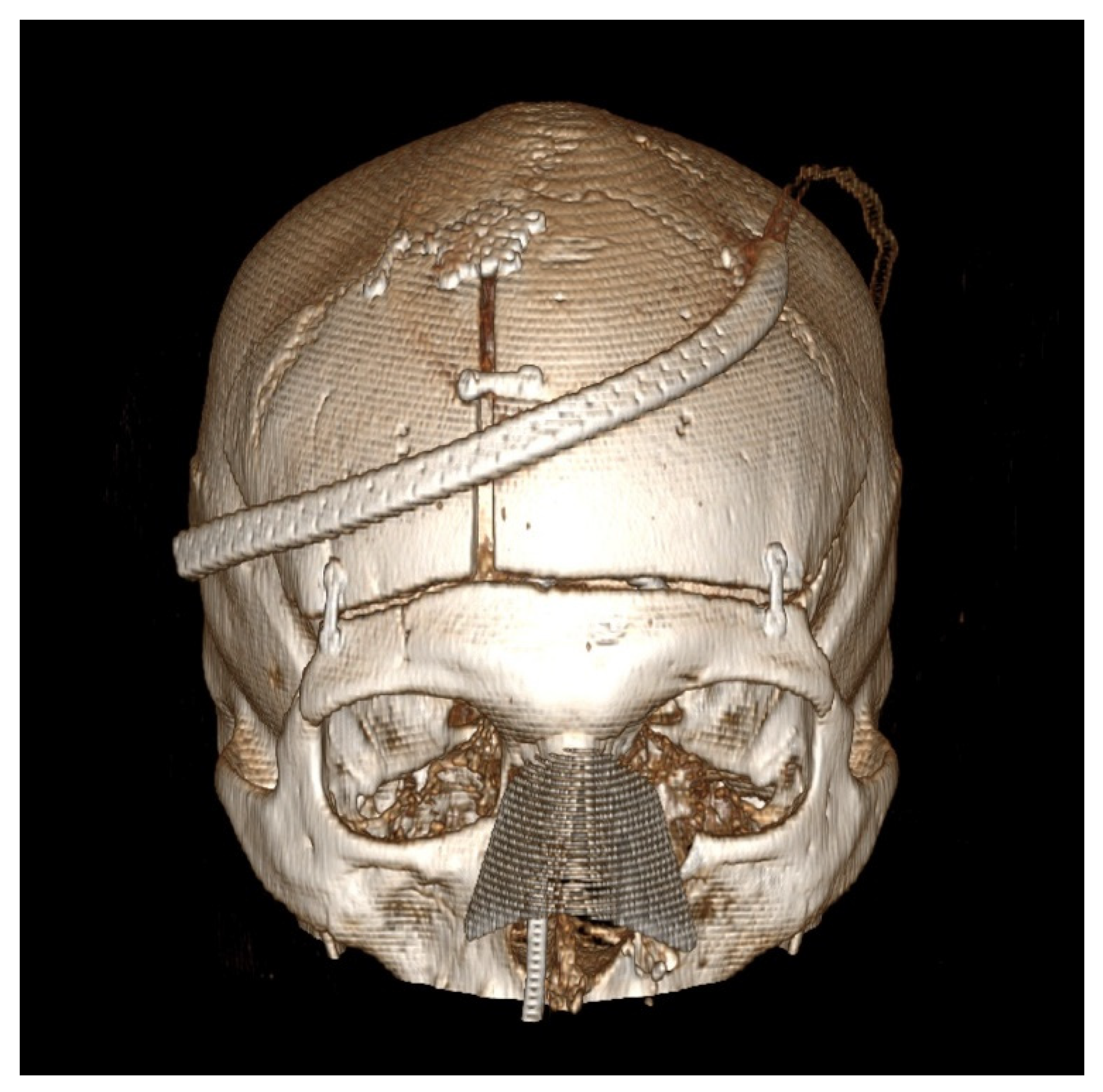 Brainsci 12 00163 g002