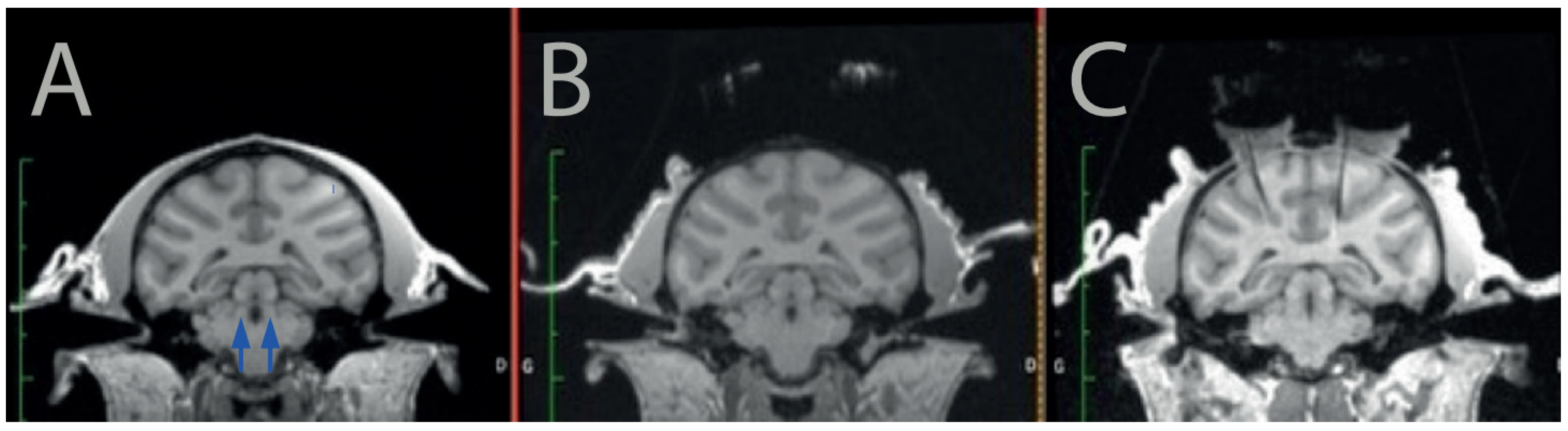 Brainsci 12 00206 g001 550