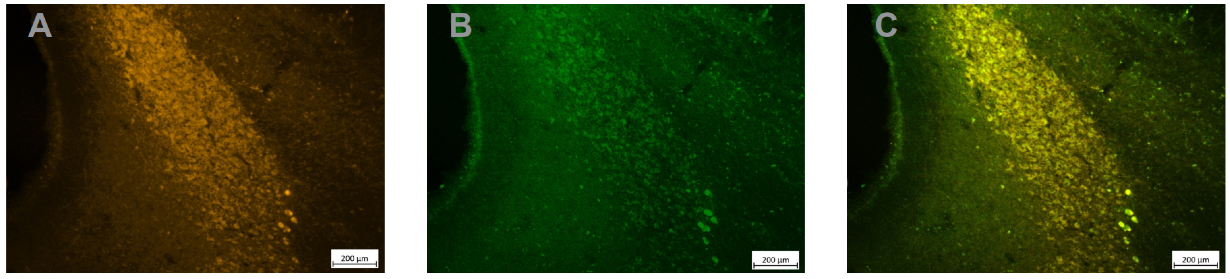 Brainsci 12 00206 g005 550