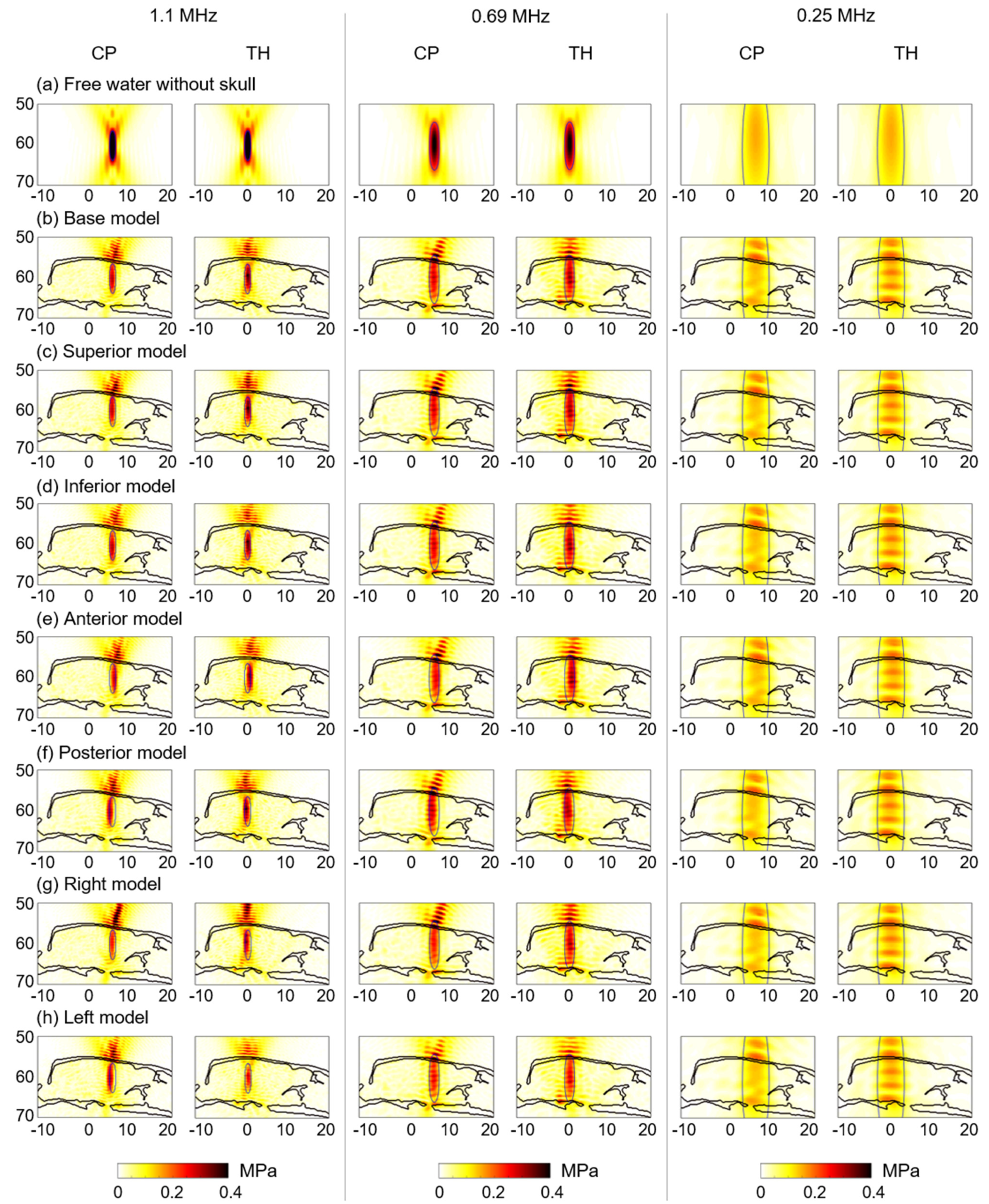 Brainsci 12 00216 g004