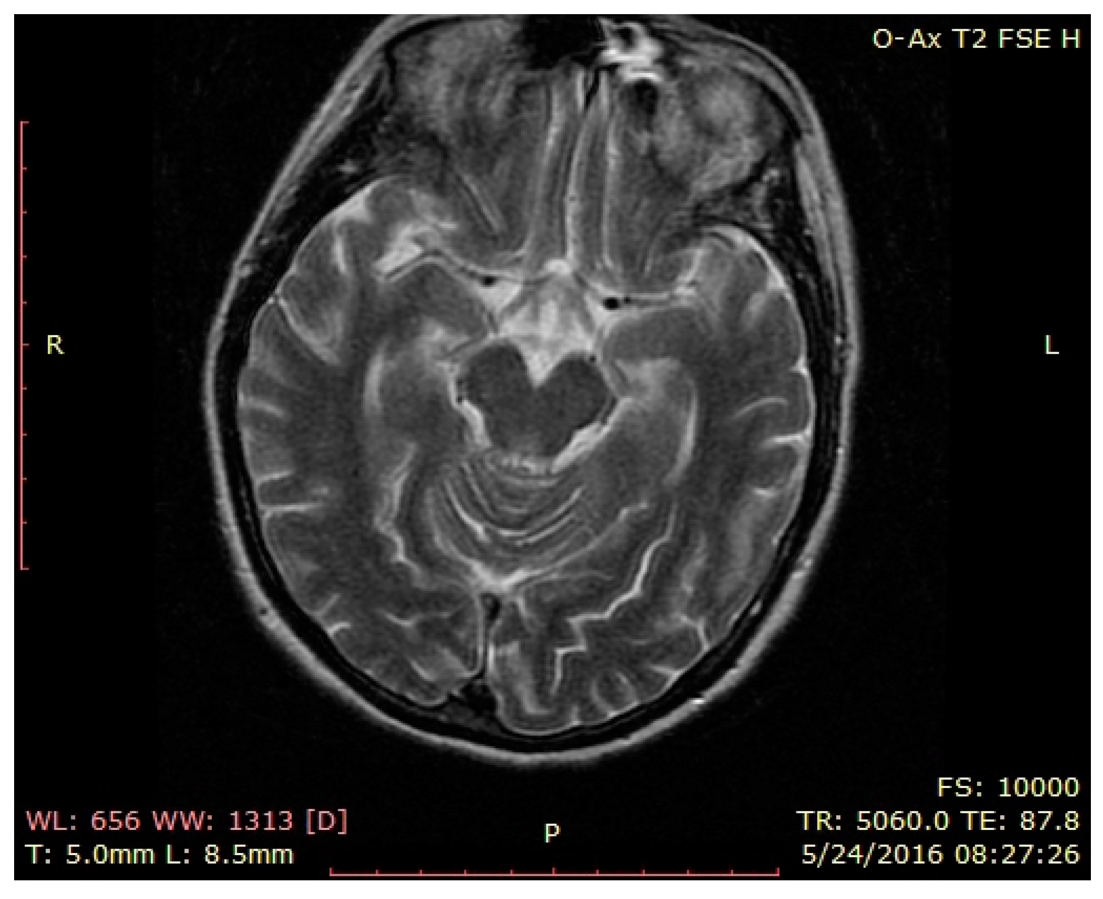 Brainsci 12 00221 g001