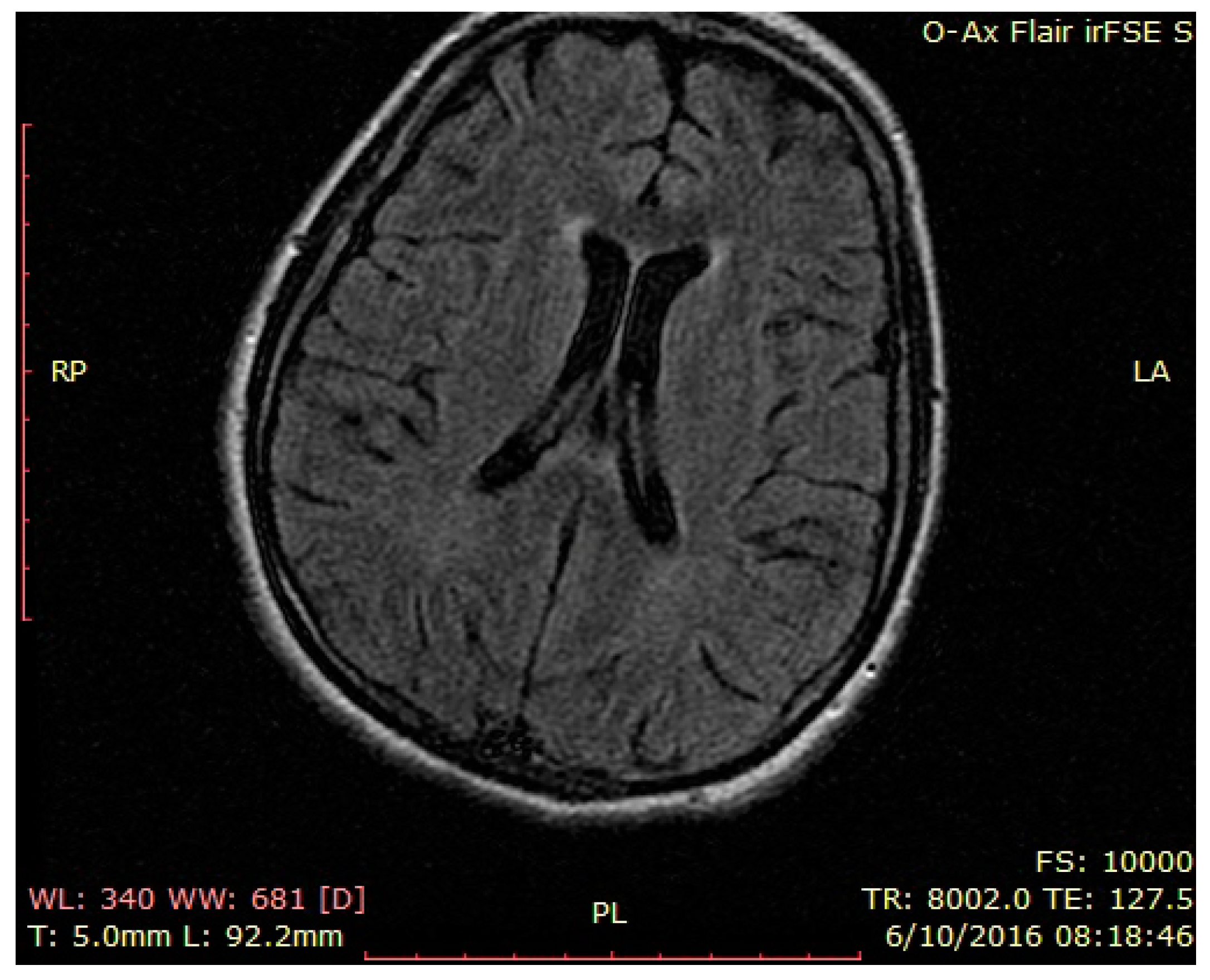 Brainsci 12 00221 g006