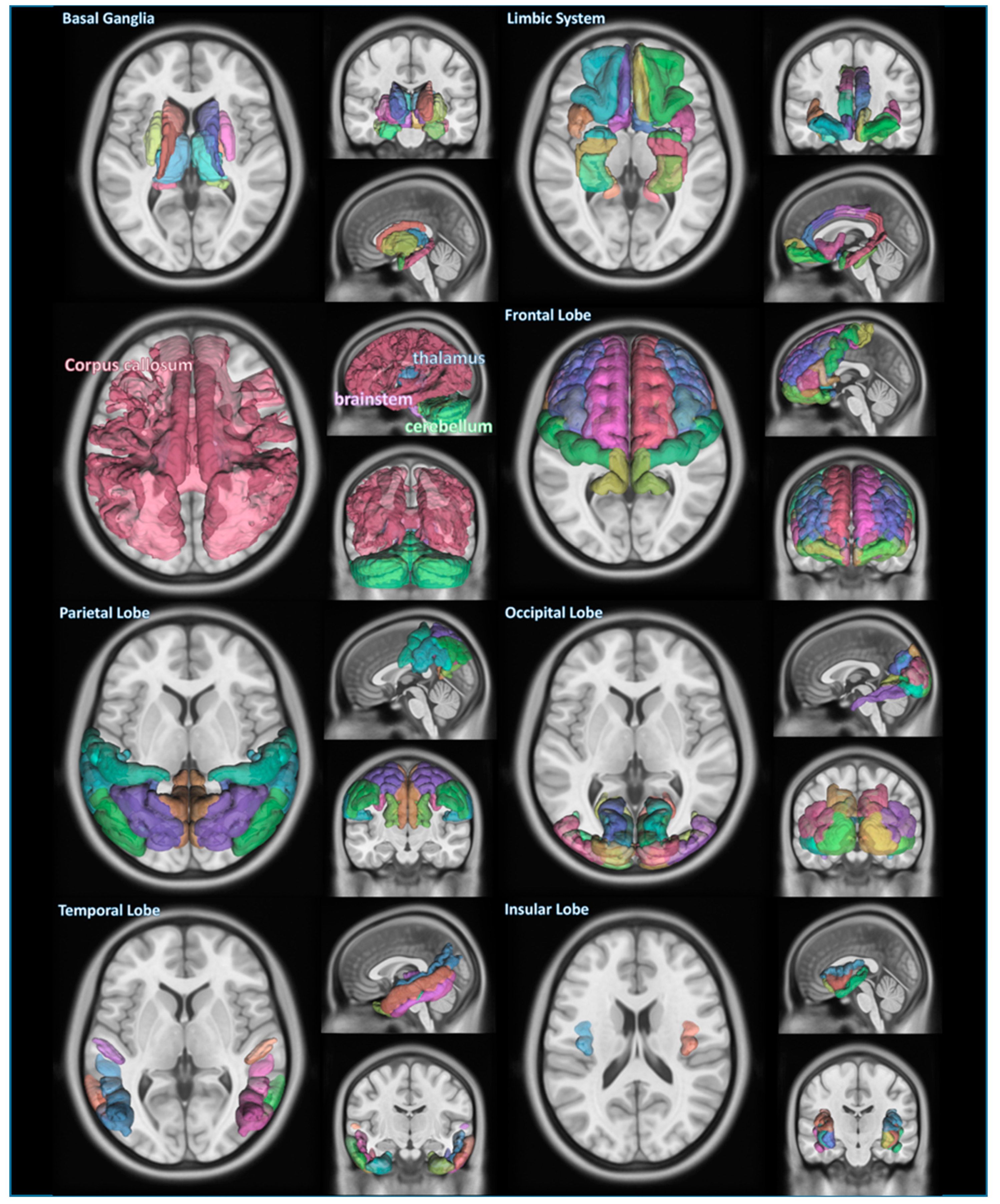 Brainsci 12 00227 g001