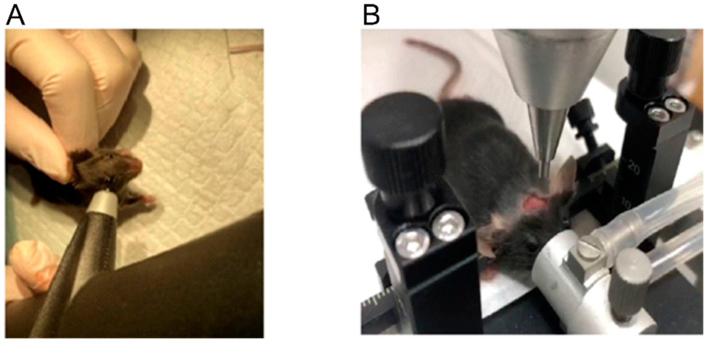 Brainsci 12 00232 g001