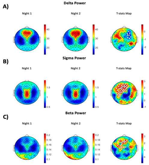 human brain mapping sci journal human brain mapping sci journal