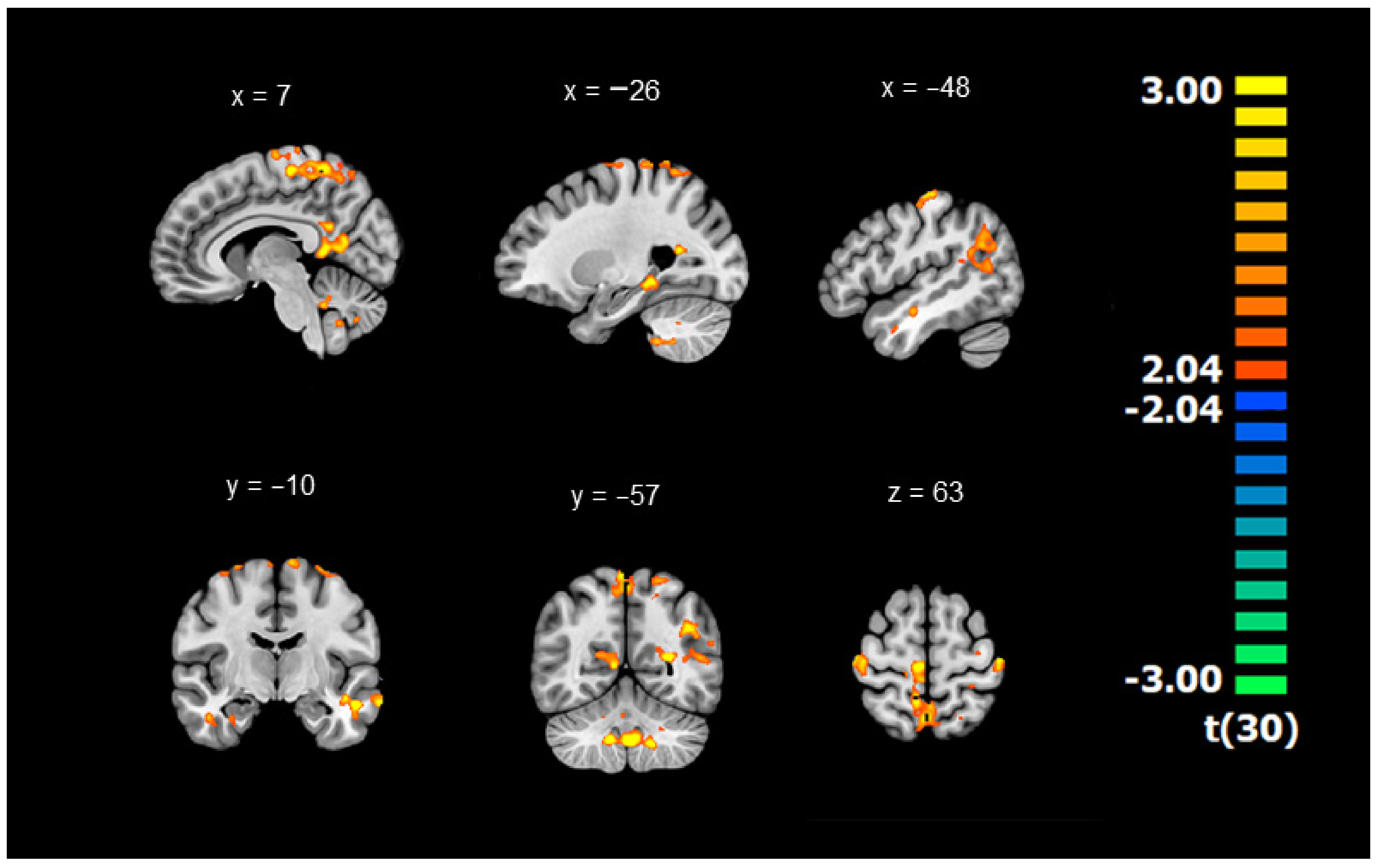 Brainsci 12 00243 g0a1 550