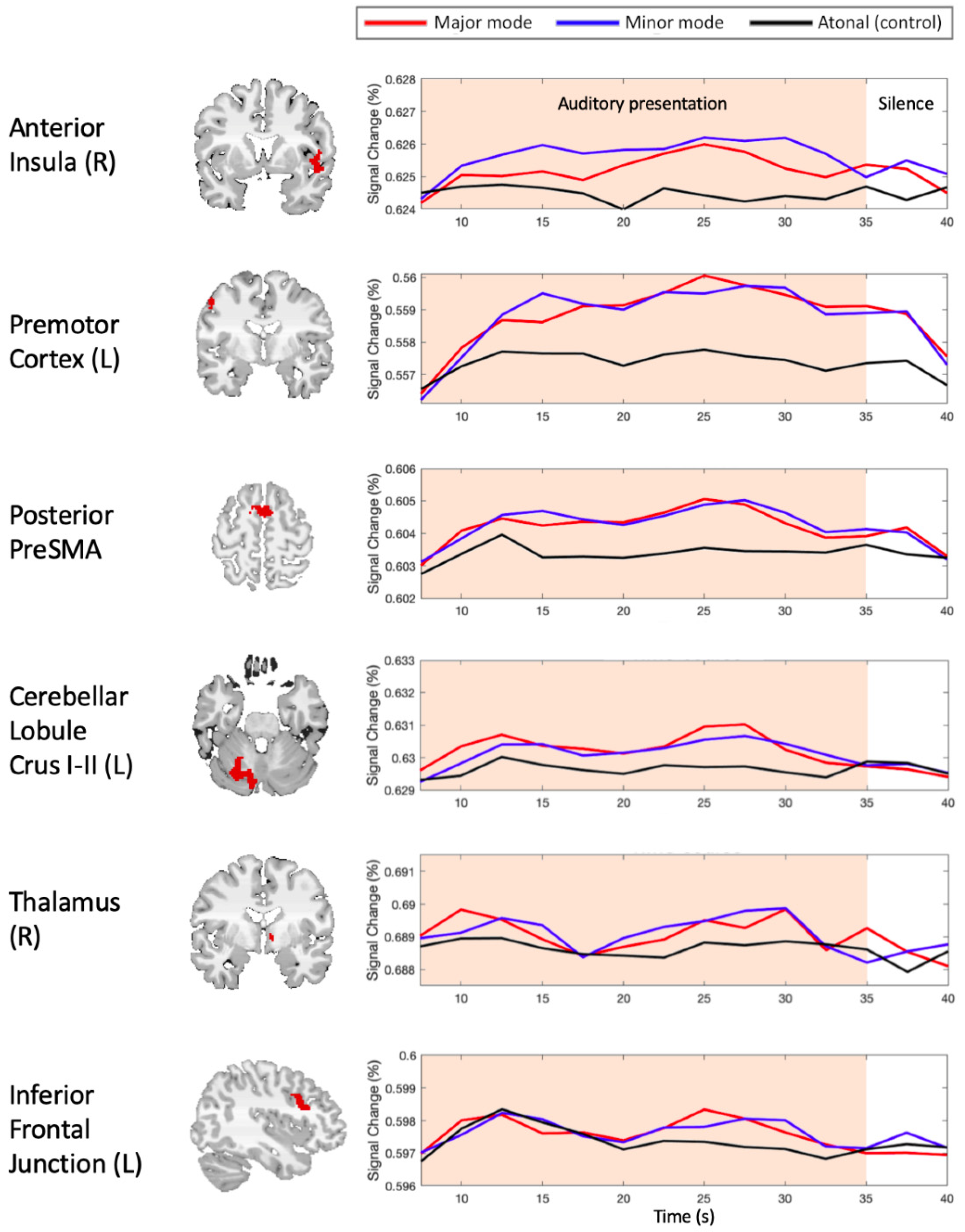 Brainsci 12 00261 g004
