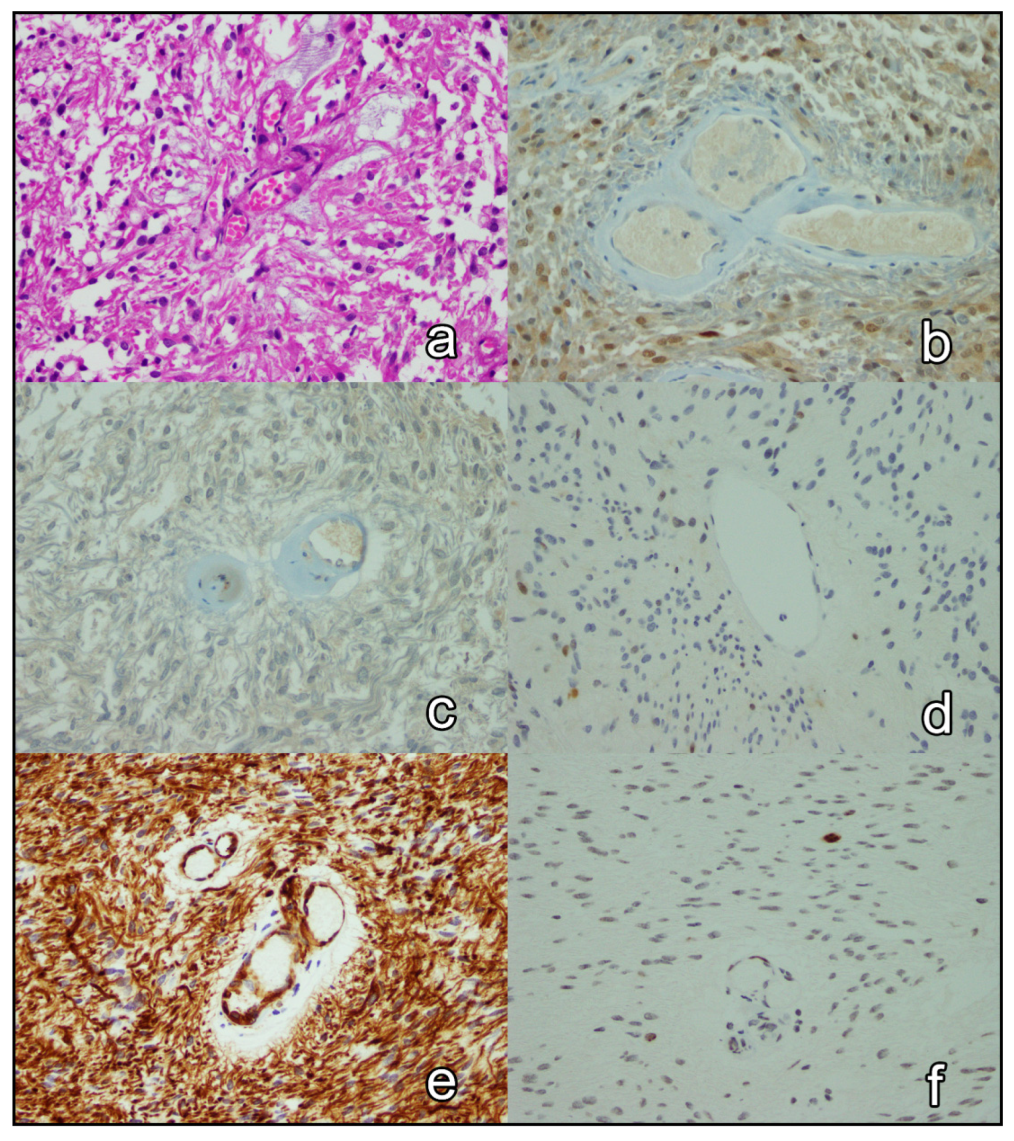 Brainsci 12 00282 g002 550