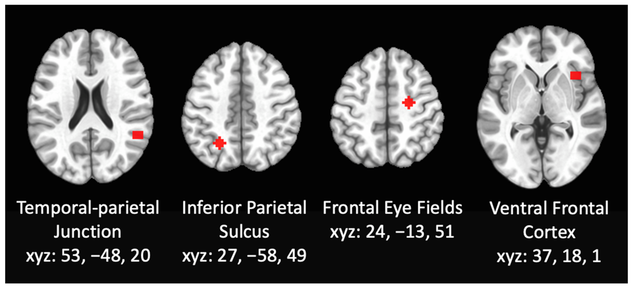 Brainsci 12 00287 g001 Brainsci 12 00287 g001