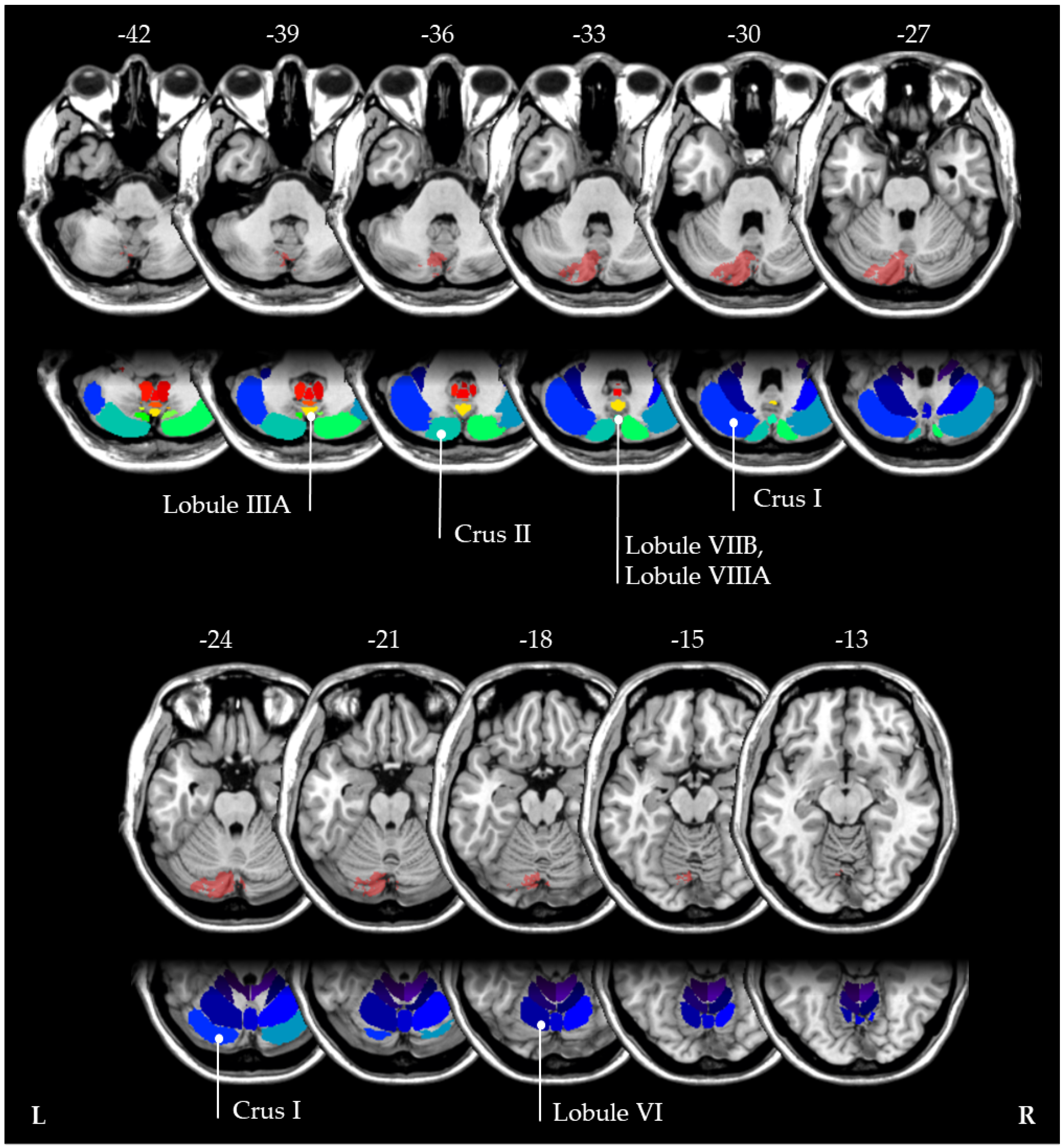 Brainsci 12 00290 g003 Brainsci 12 00290 g003