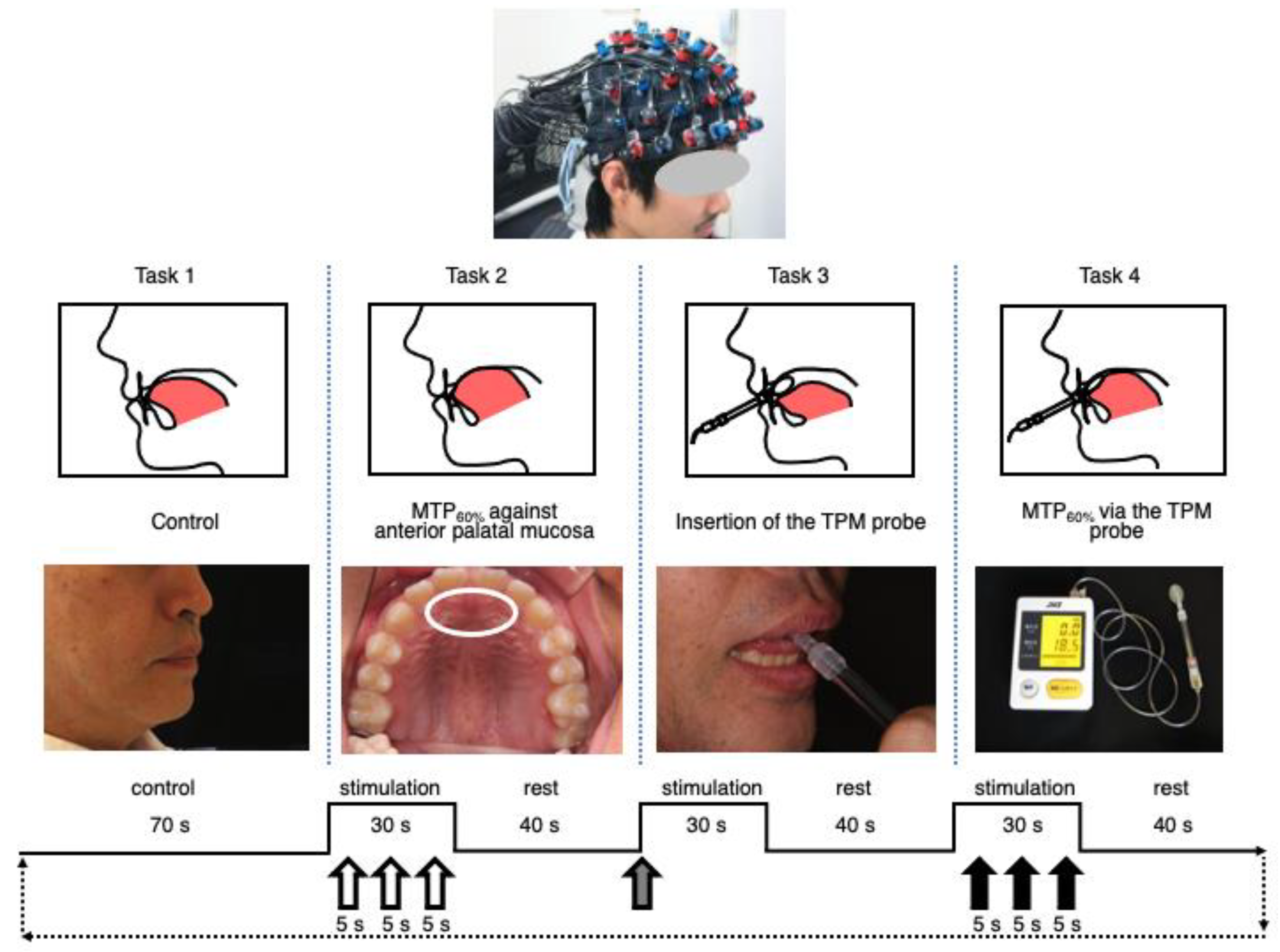 Brainsci 12 00296 g001 550