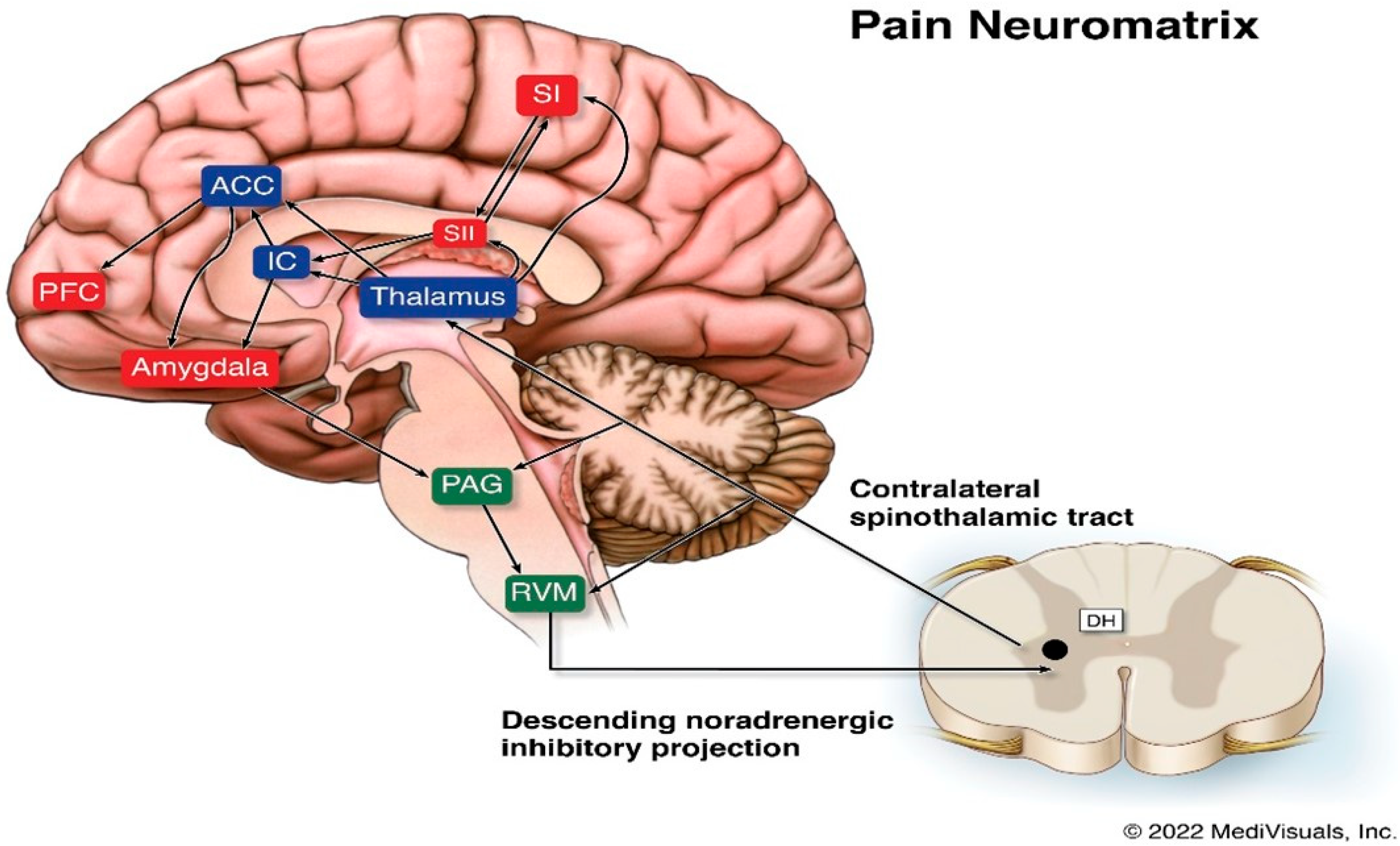 Chronic Pain Linked to Brain Signals in Orbitofrontal Cortex - The