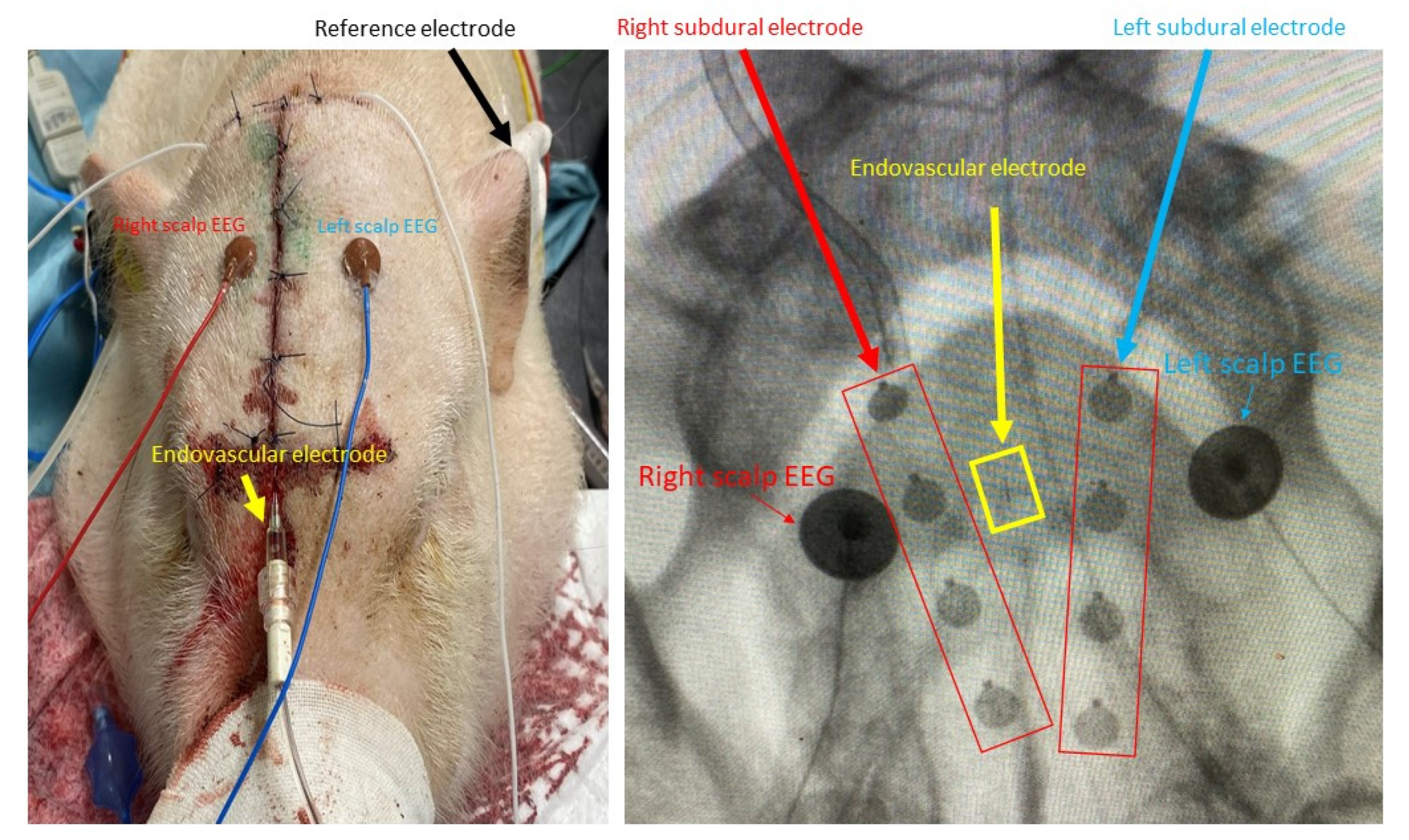 Brainsci 12 00309 g002 Brainsci 12 00309 g002