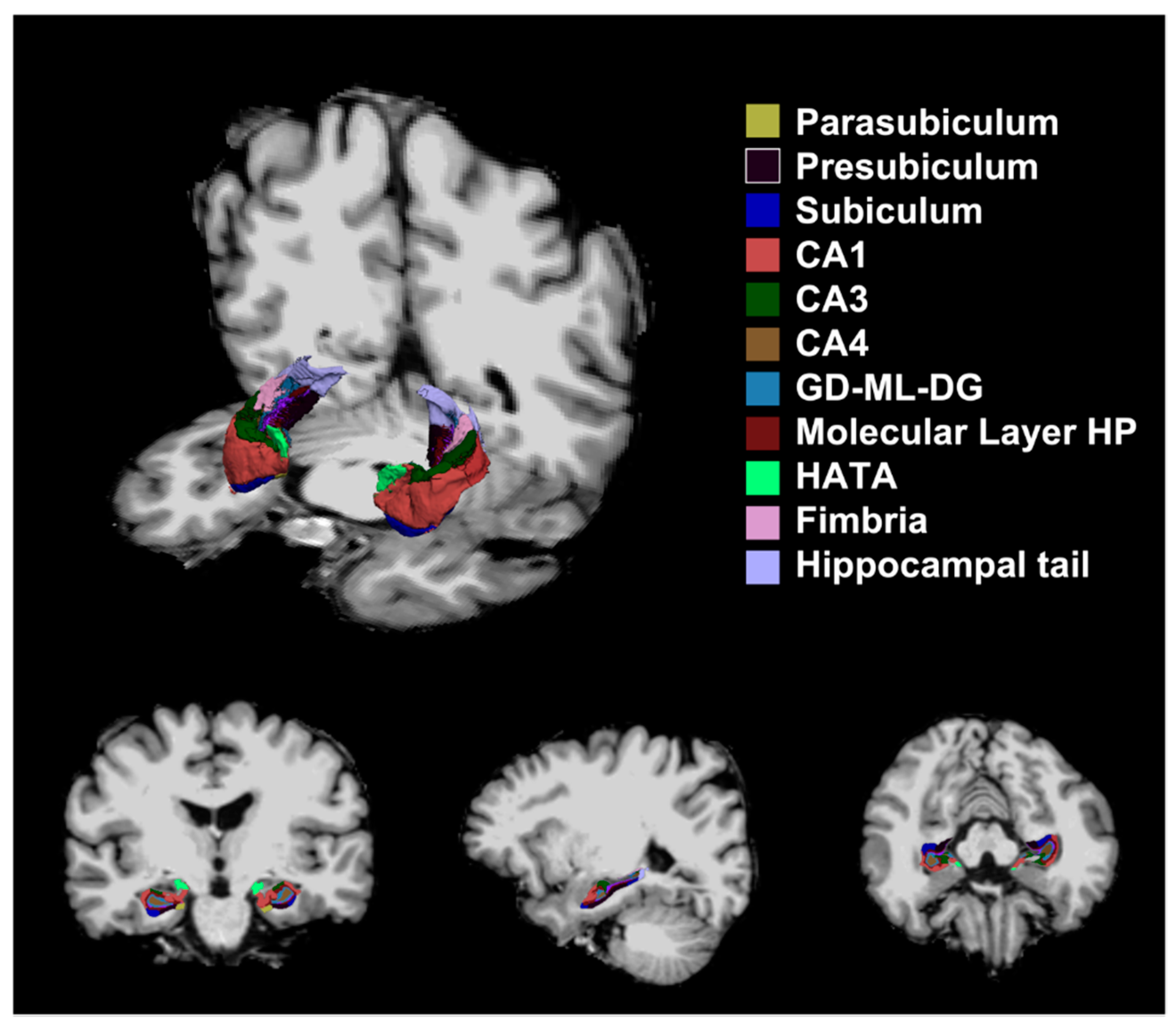 Hippocampal Subfields and White Matter Connectivity in