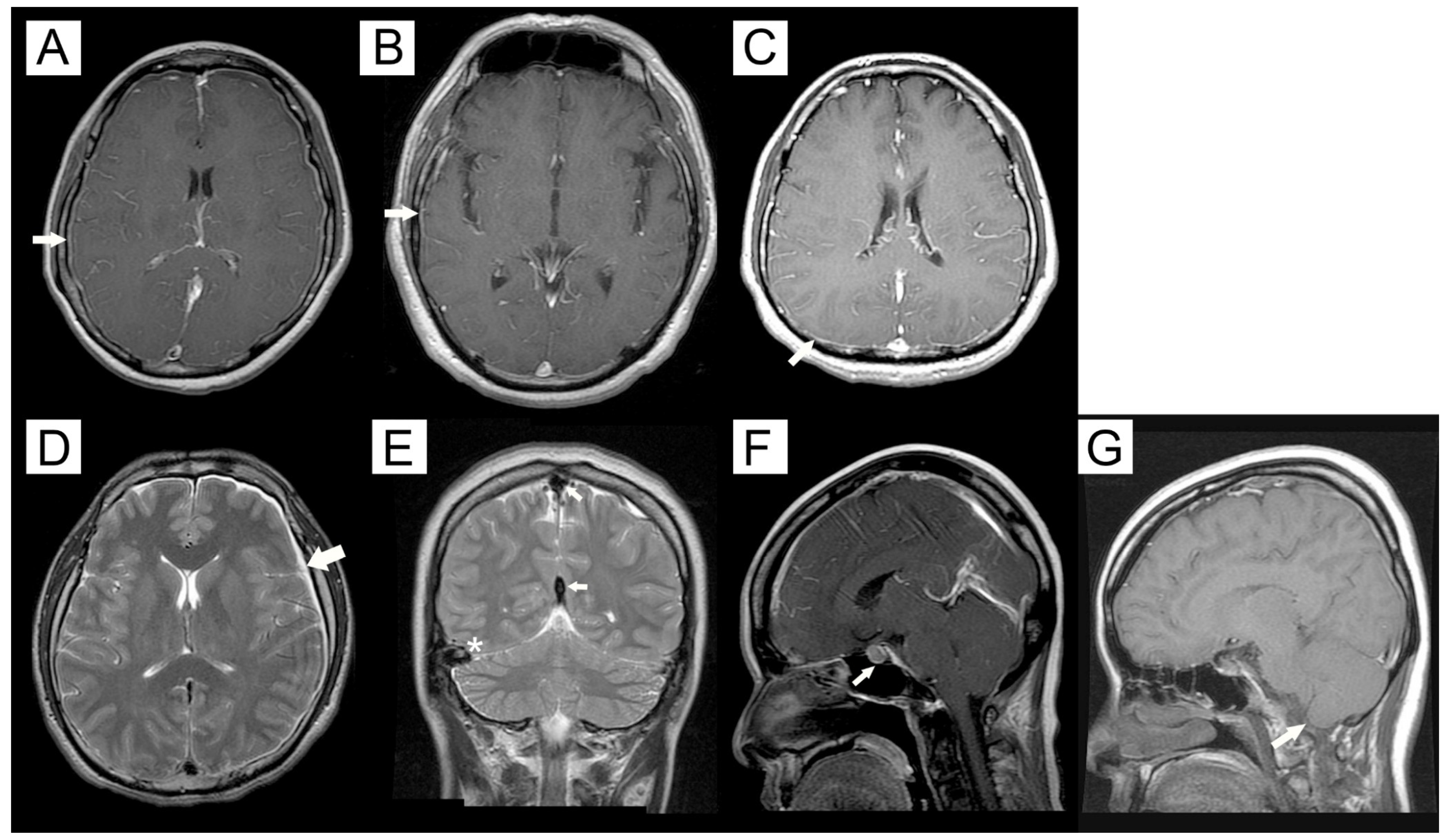 Brainsci 12 00340 g003