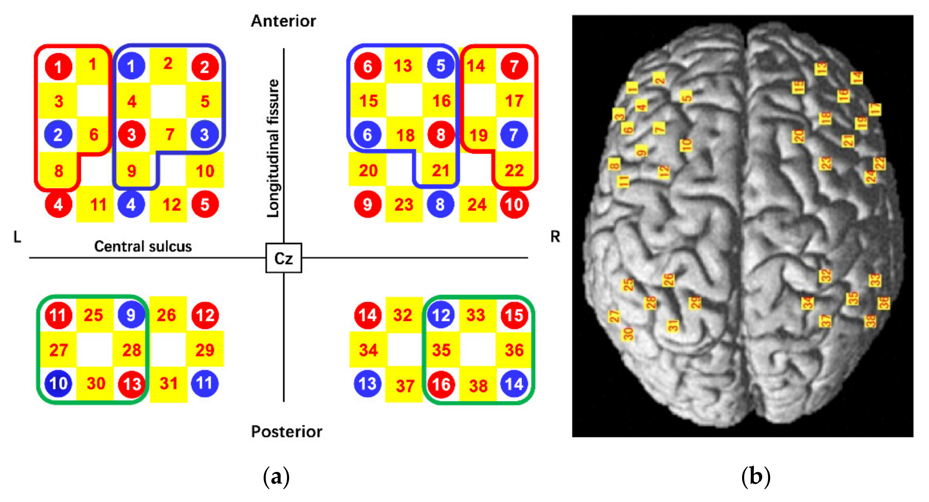 Brainsci 12 00349 g003 Brainsci 12 00349 g003