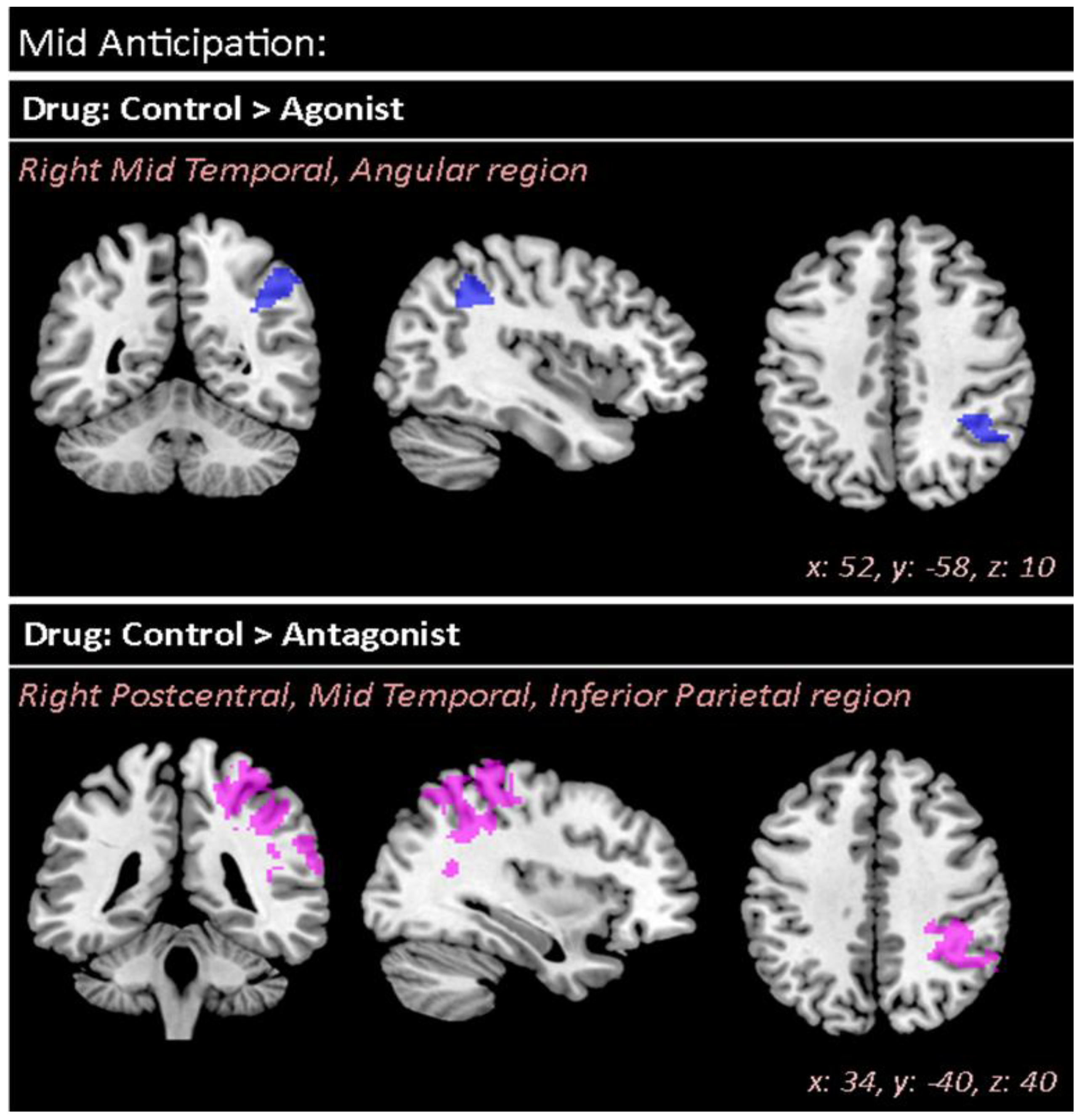 Brainsci 12 00351 g003 Brainsci 12 00351 g003