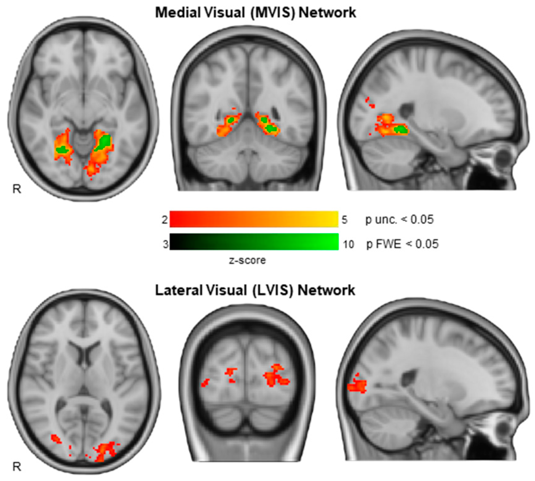 Brainsci 12 00355 g003