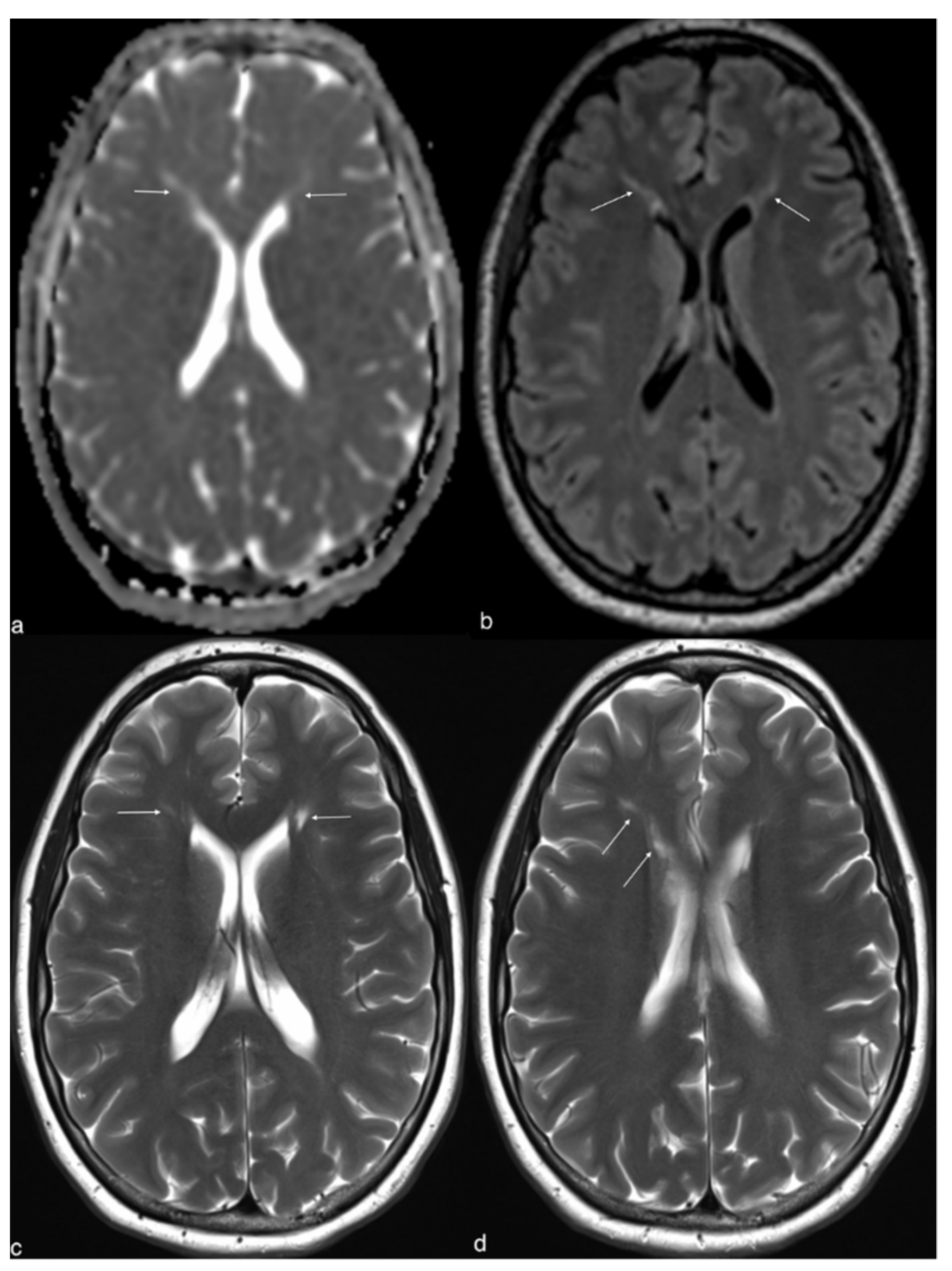 Brainsci 12 00389 g001 Brainsci 12 00389 g001