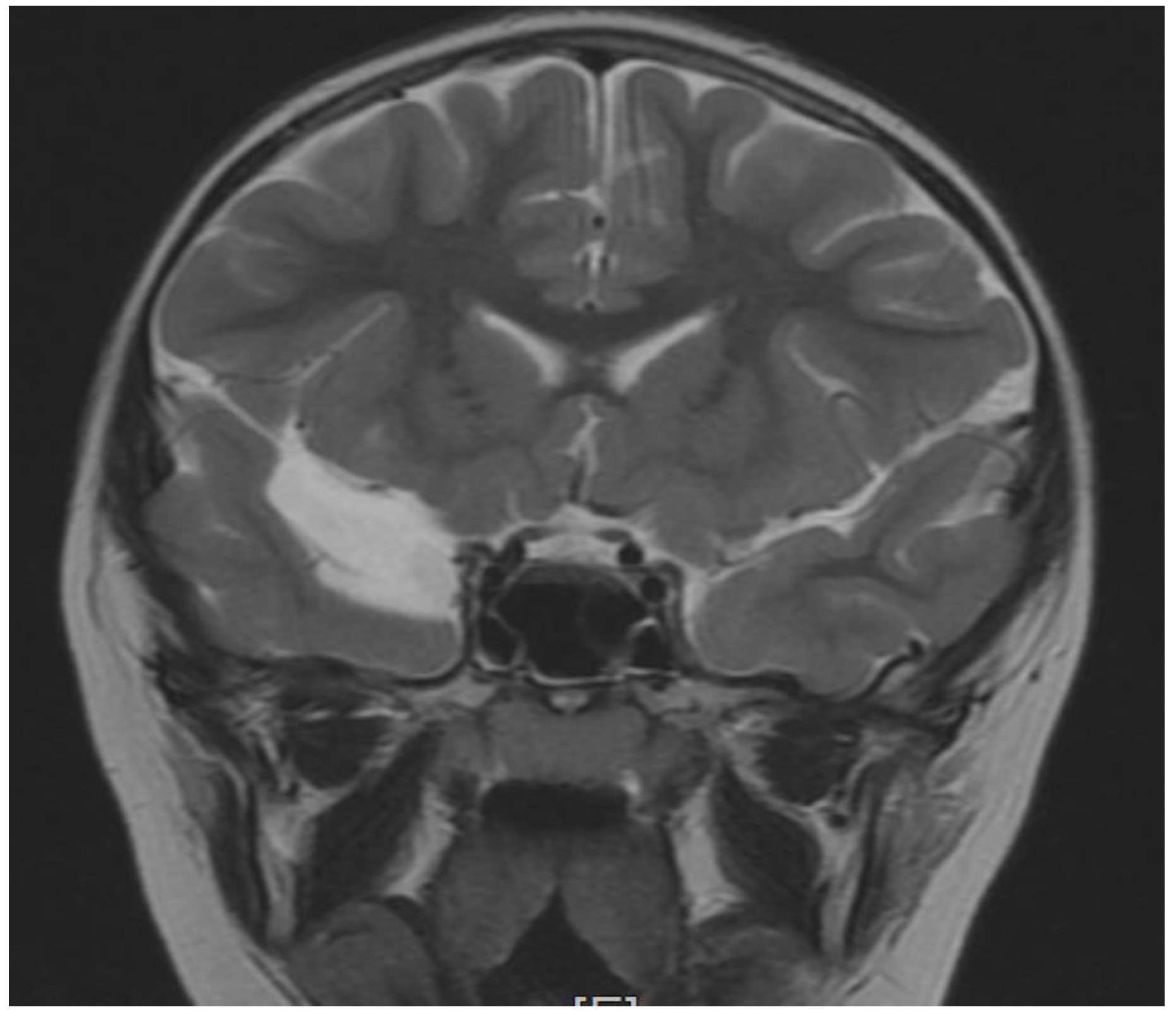 Brainsci 12 00390 g002