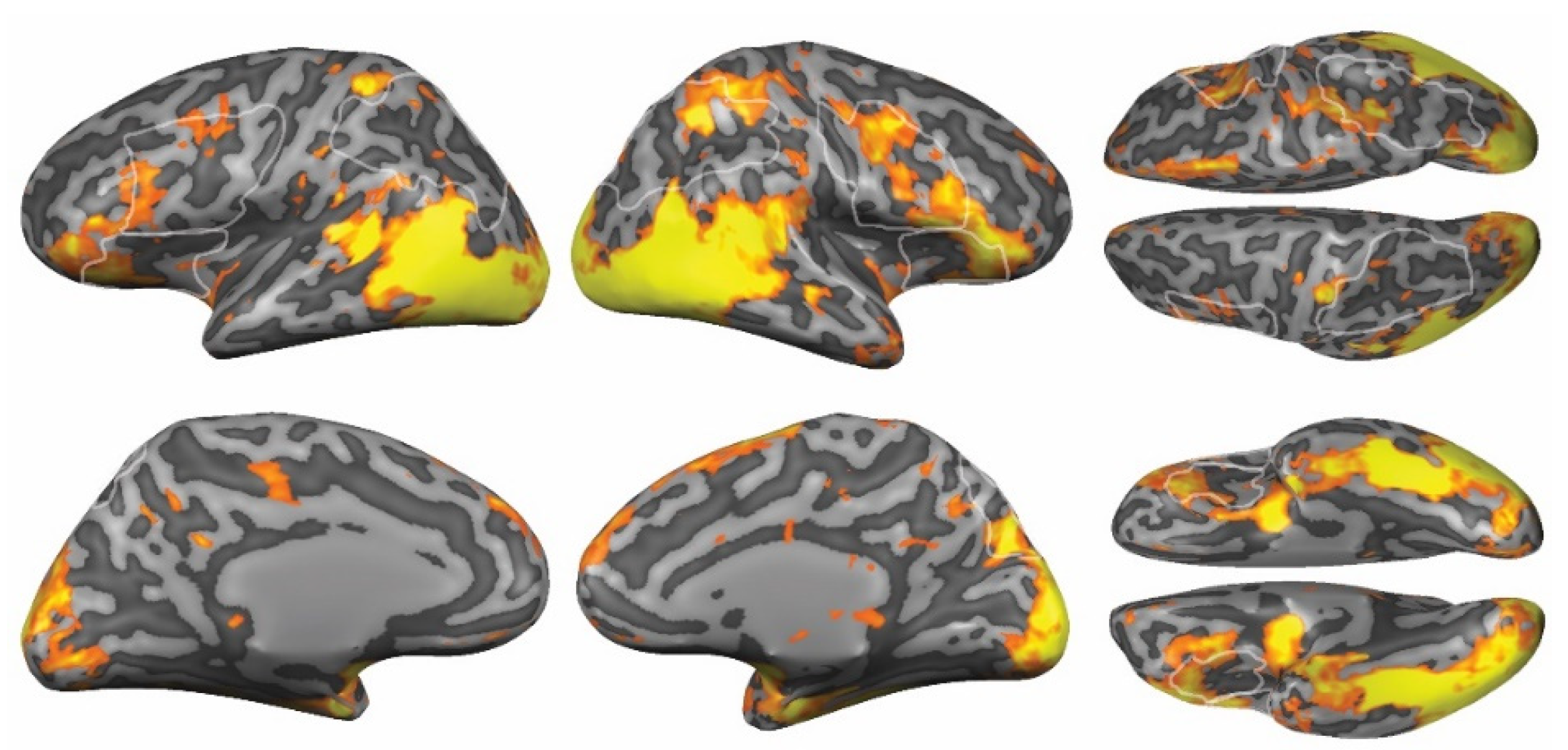 Brainsci 12 00391 g003