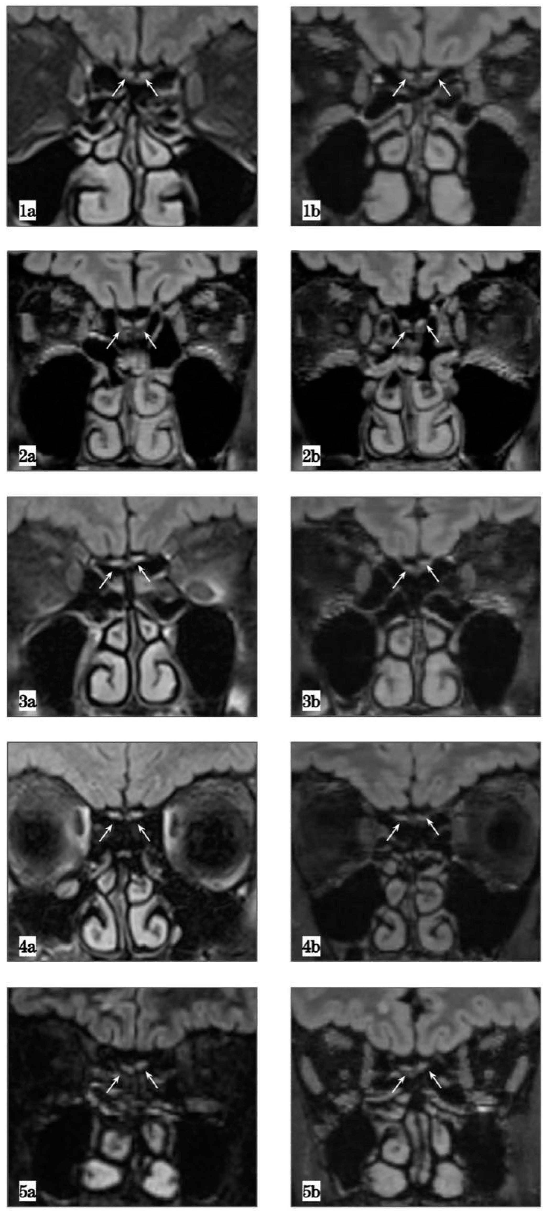 Brainsci 12 00430 g001 550