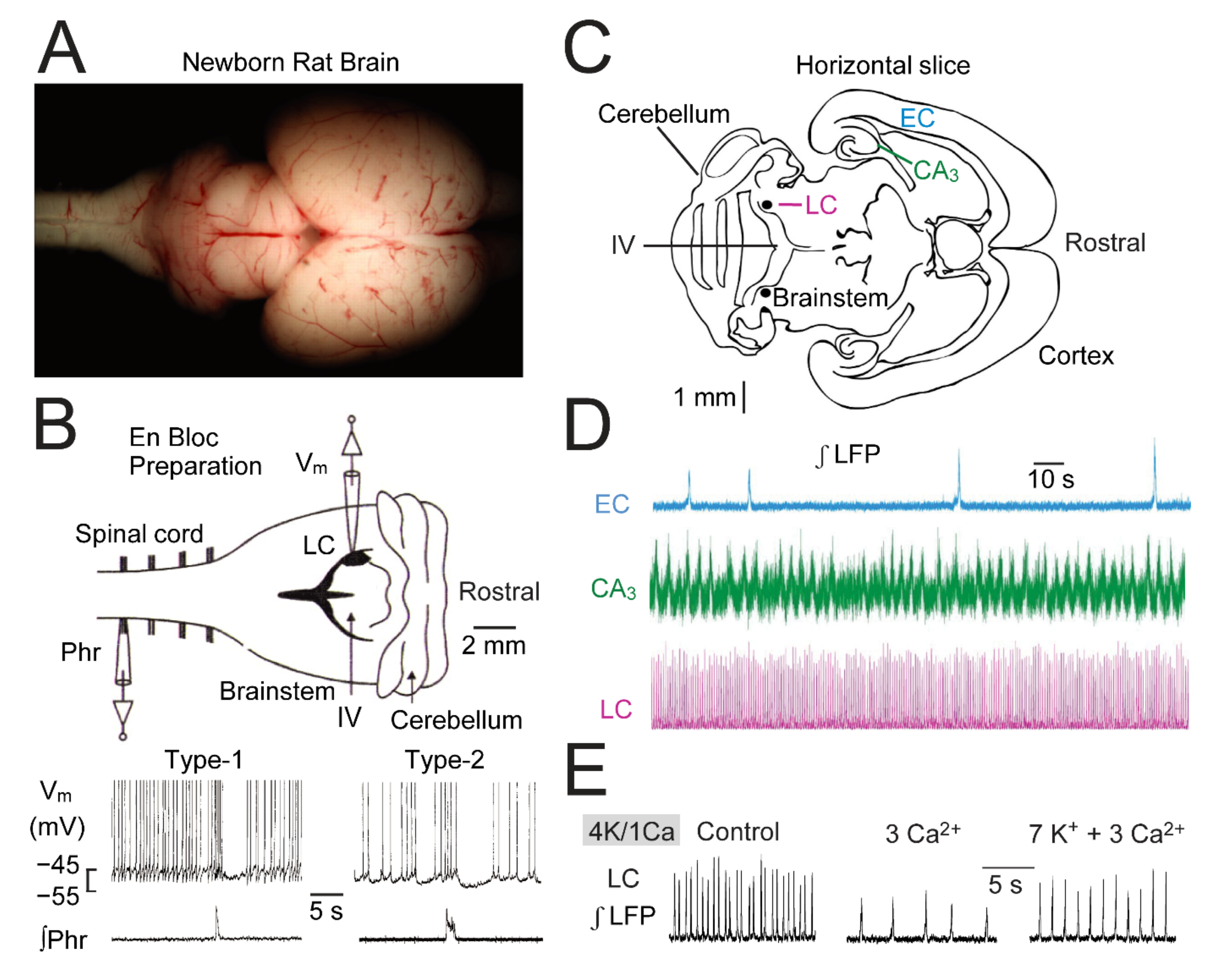 Brainsci 12 00437 g002 Brainsci 12 00437 g002