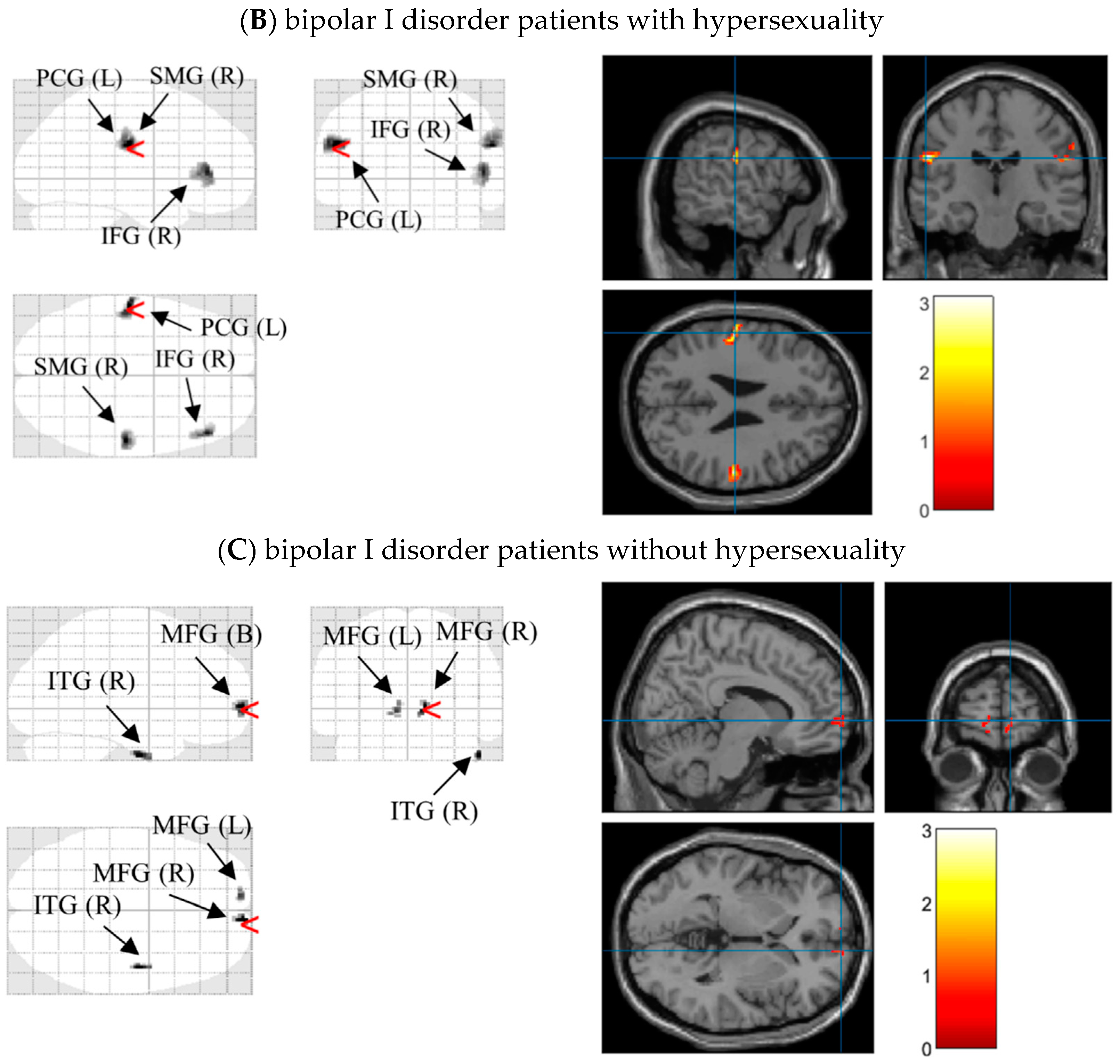 Brainsci 12 00441 g004b