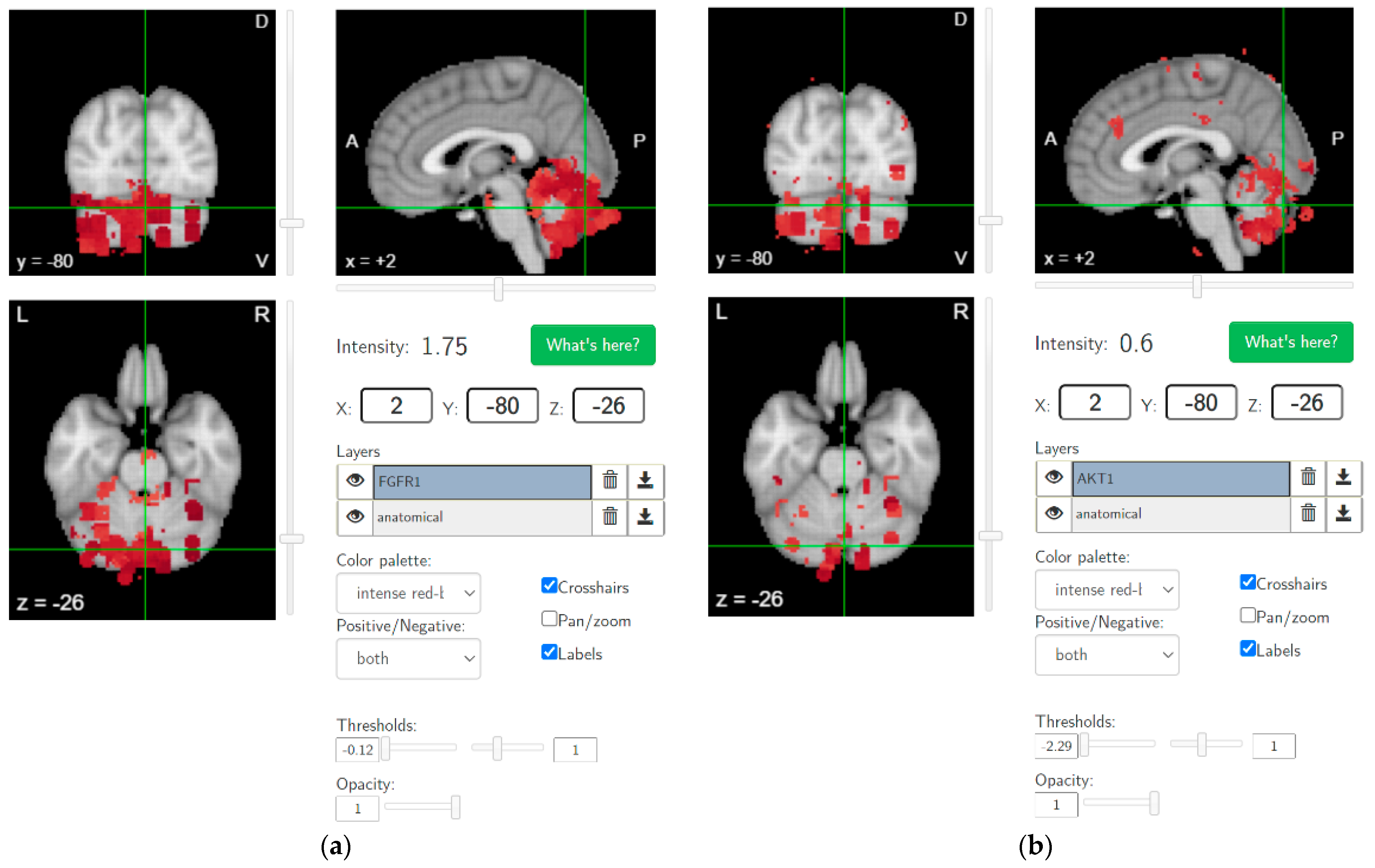 Brainsci 12 00445 g004