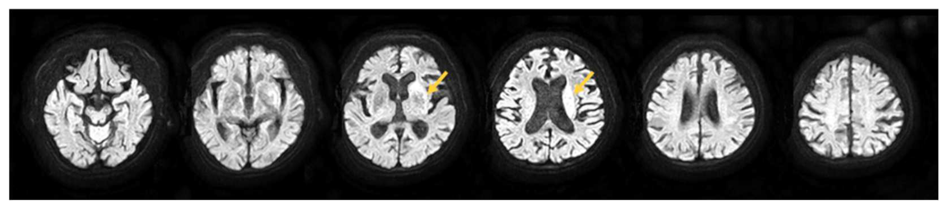 Brainsci 12 00452 g001