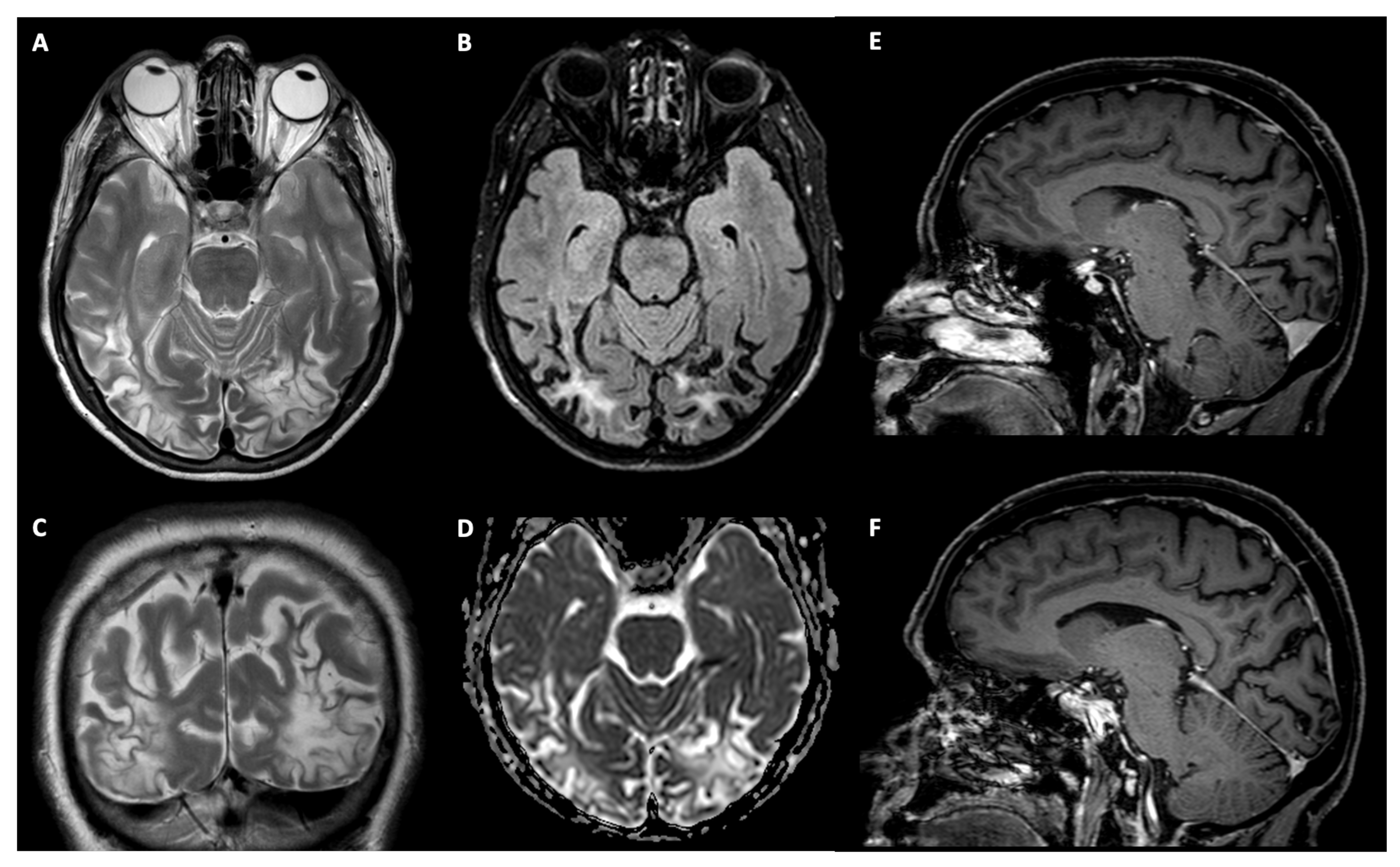 Brainsci 12 00480 g002