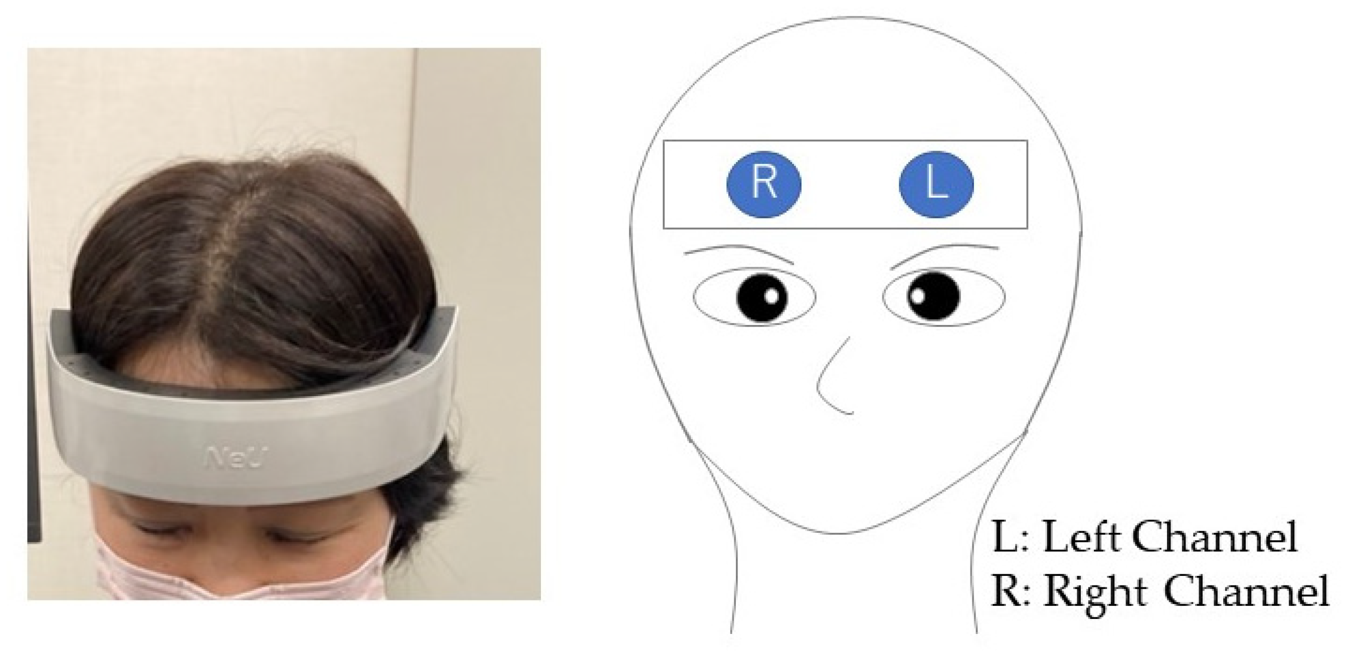 Brainsci 12 00488 g004 550
