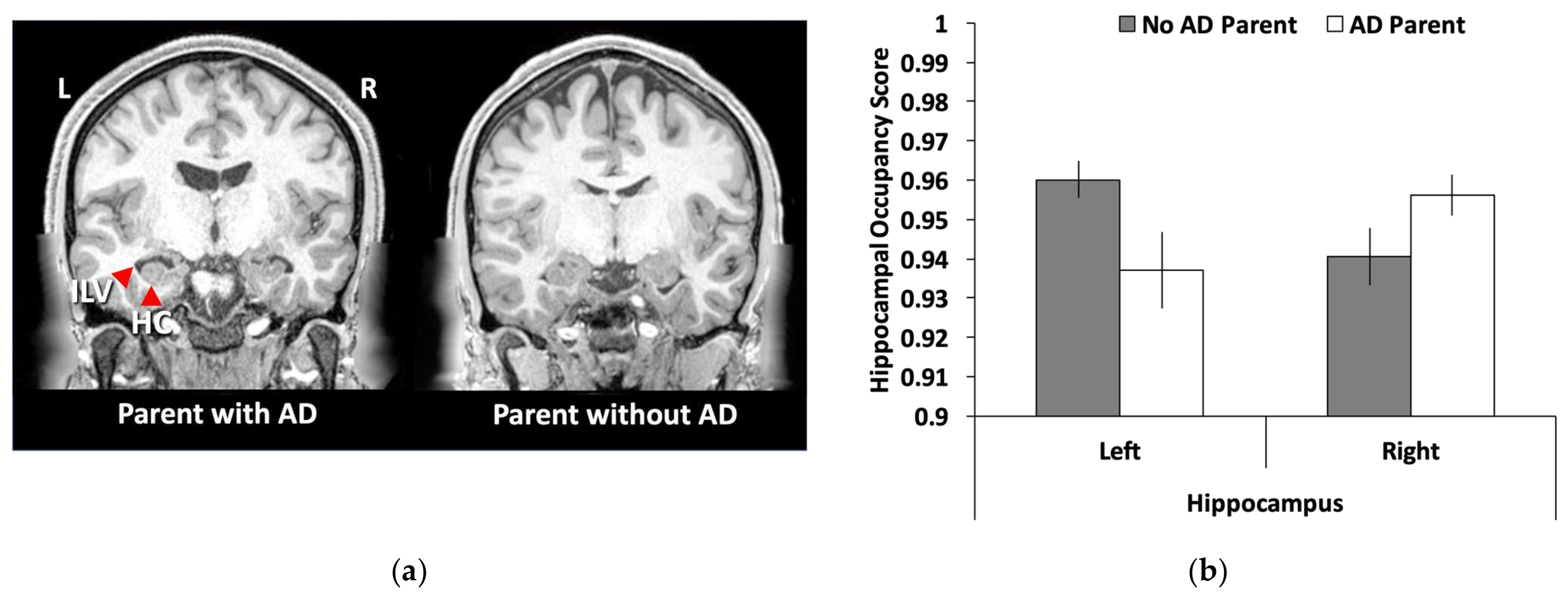Brainsci 12 00496 g002