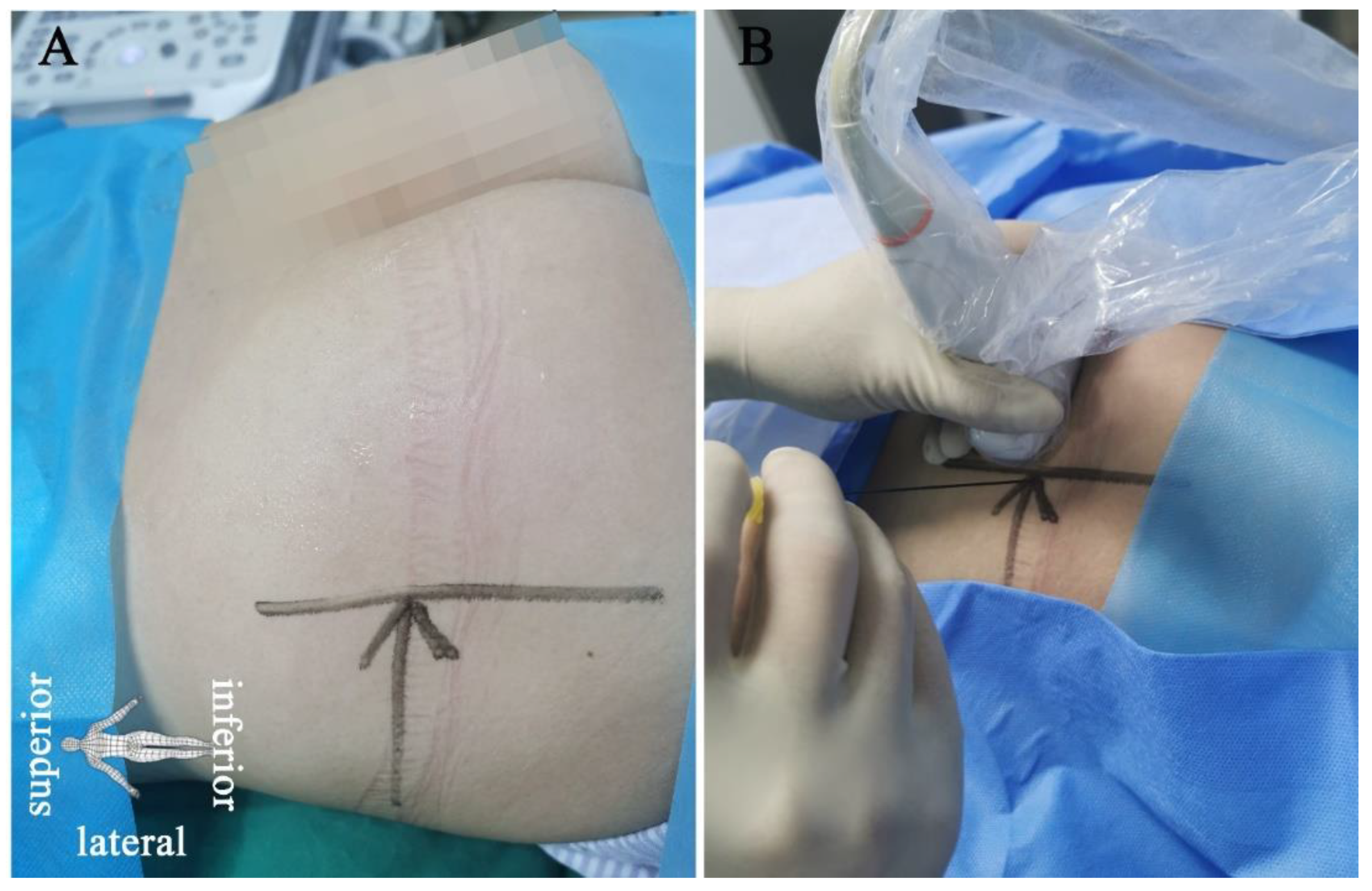 Brainsci 12 00510 g002 550