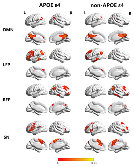 The Effect of APOE ɛ4 on the Functional Connectivity in Frontoparietal ...
