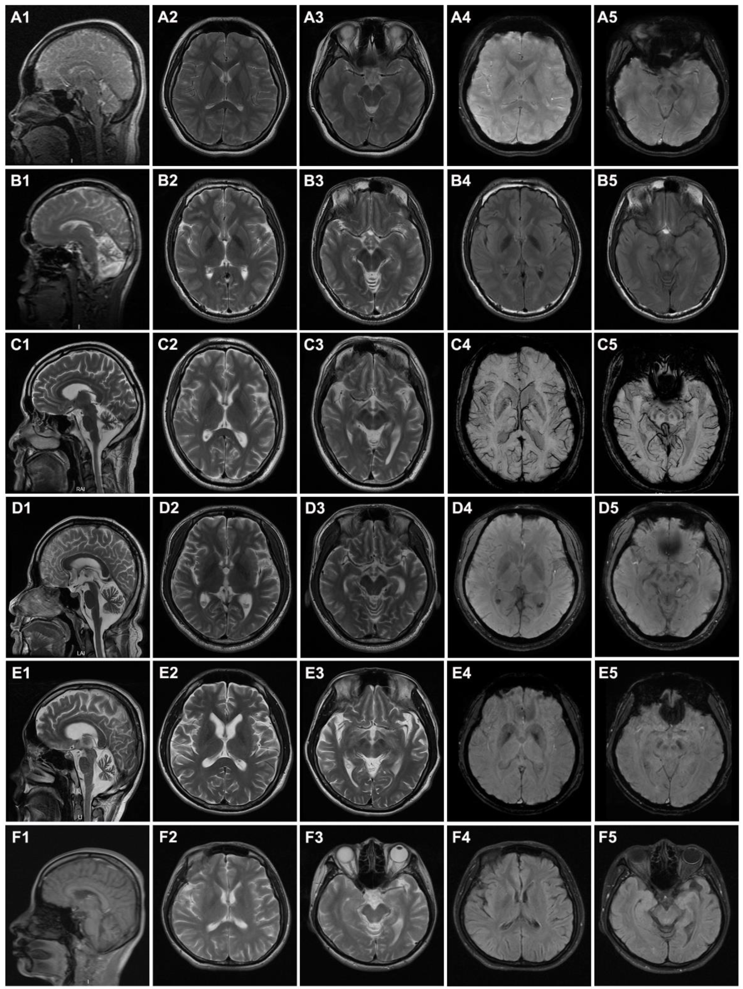 Brainsci 12 00517 g002
