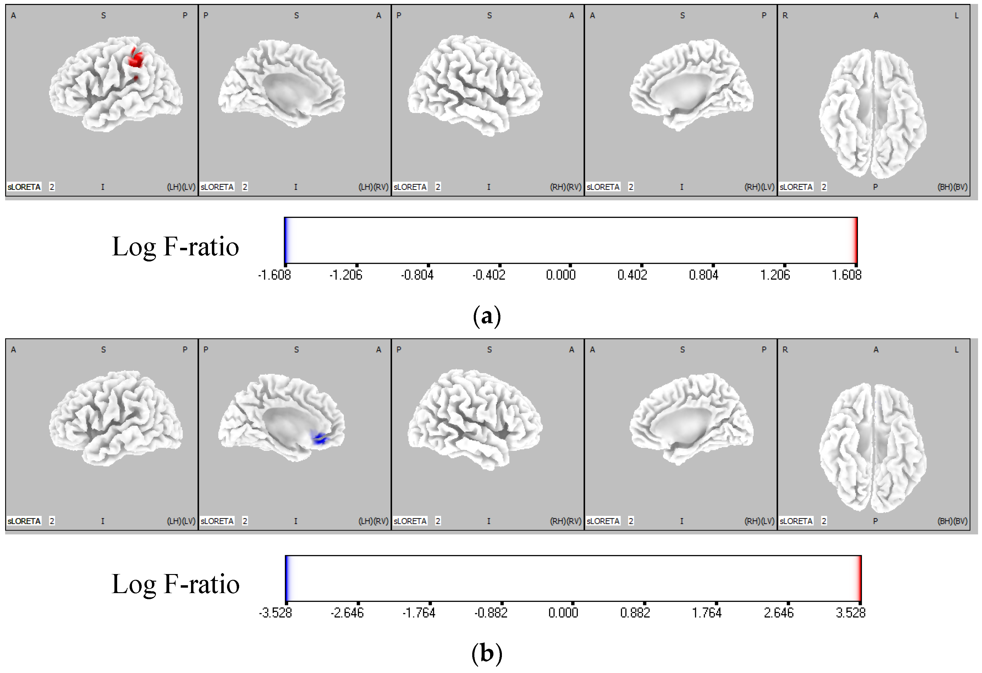 Brainsci 12 00538 g005
